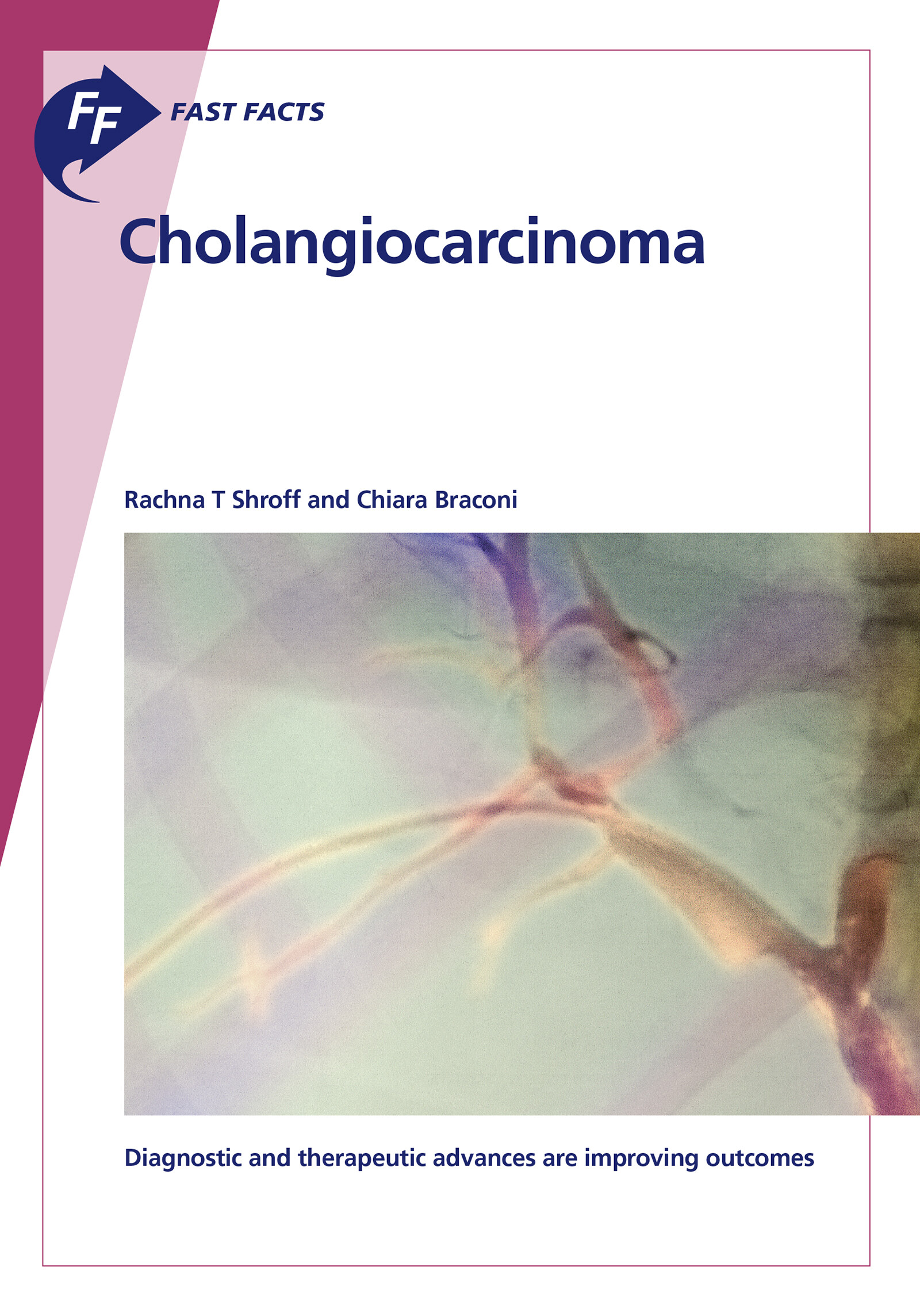 Cover Fast Facts: Cholangiocarcinoma