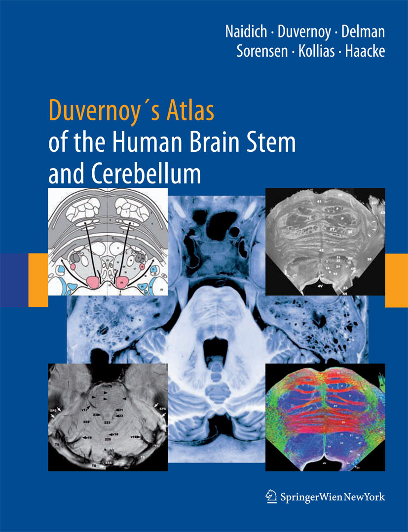 Duvernoy's Atlas of the Human Brain Stem and Cerebellum