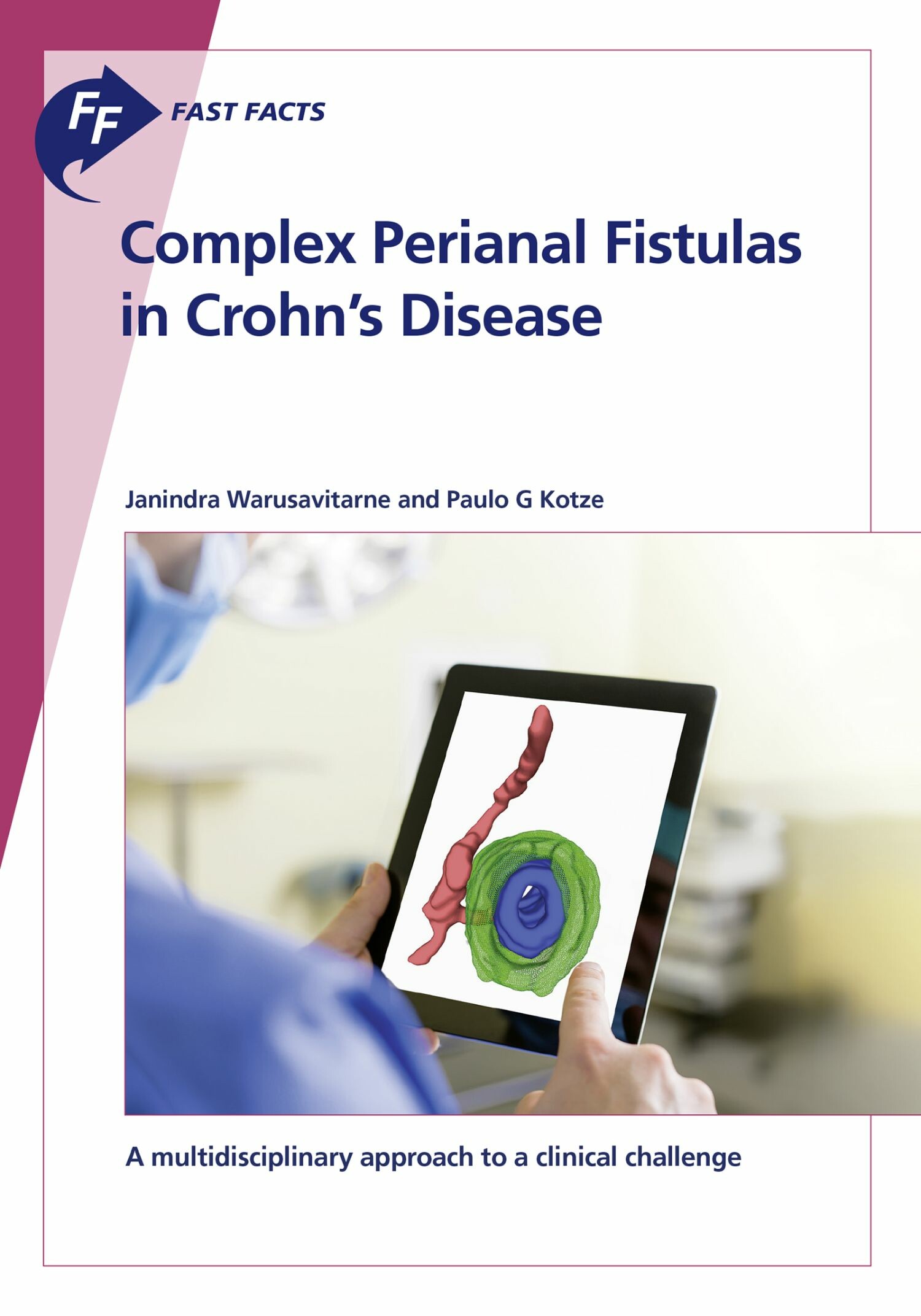 Cover Fast Facts: Complex Perianal Fistulas in Crohn's Disease