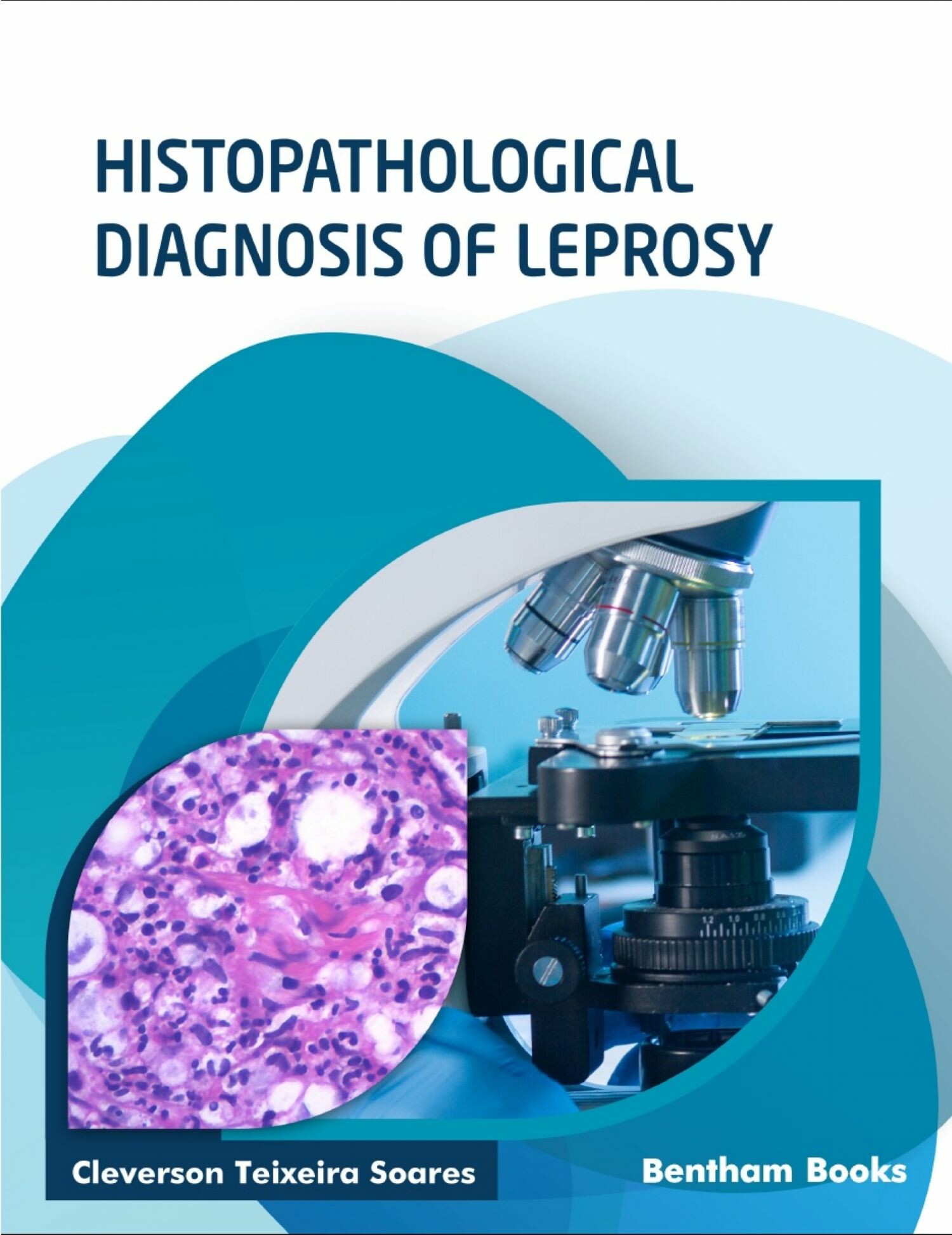 Cover Histopathological Diagnosis of Leprosy