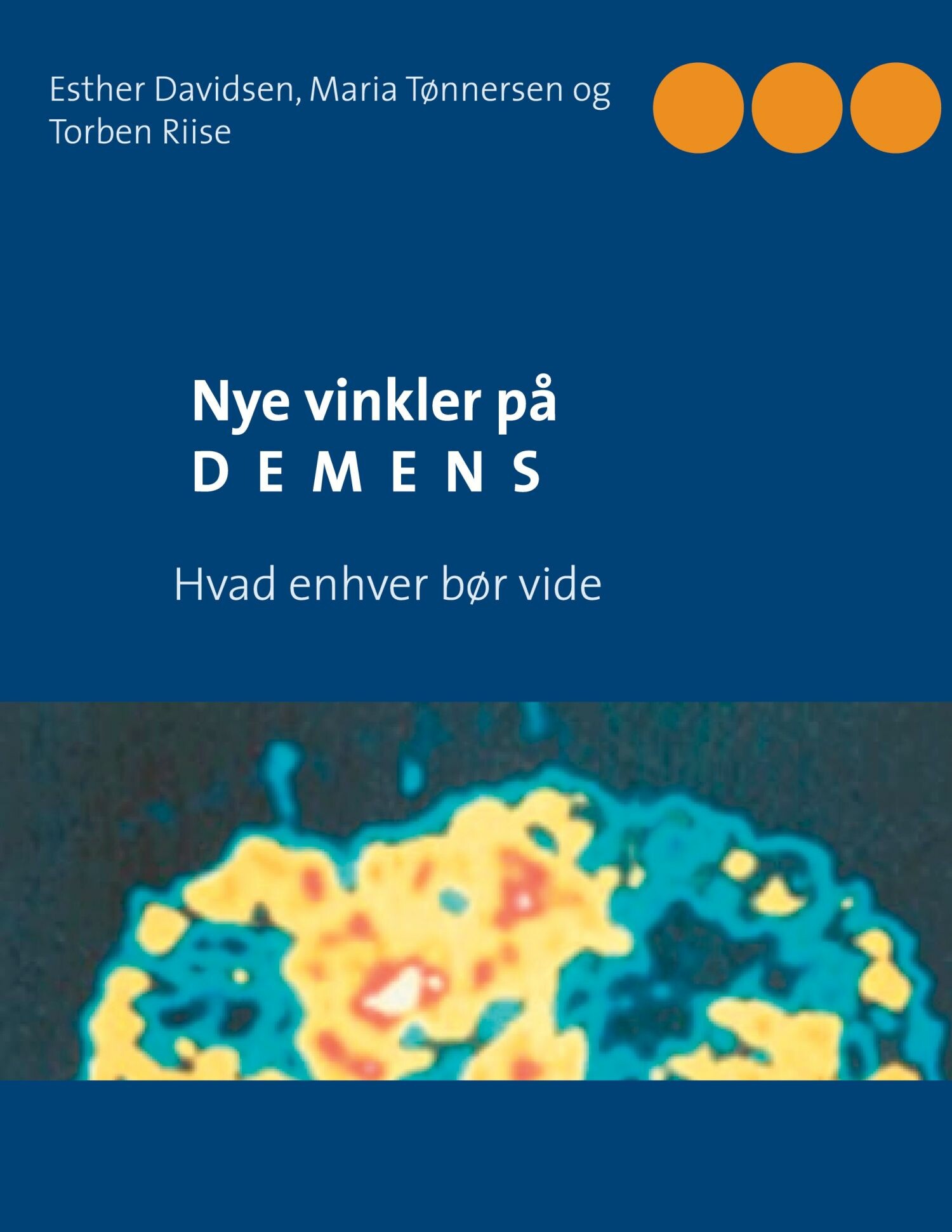 Cover Nye vinkler på demens
