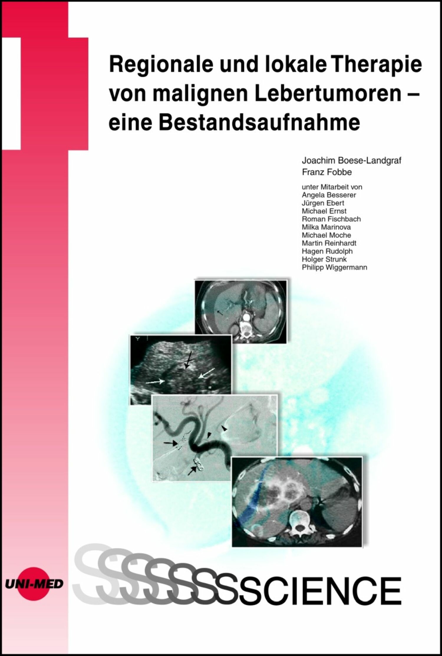 Cover Regionale und lokale Therapie von malignen Lebertumoren - eine Bestandsaufnahme