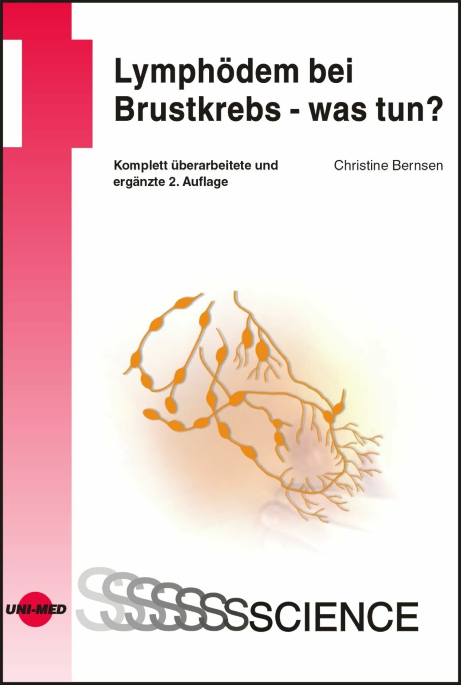 Cover Lymphödem bei Brustkrebs - was tun?