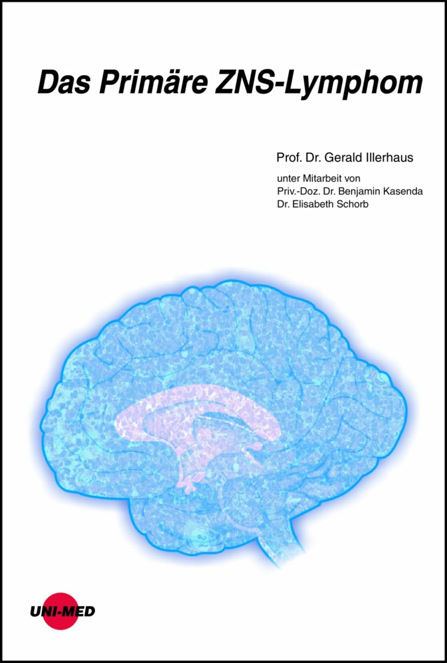 Cover Das Primäre ZNS-Lymphom