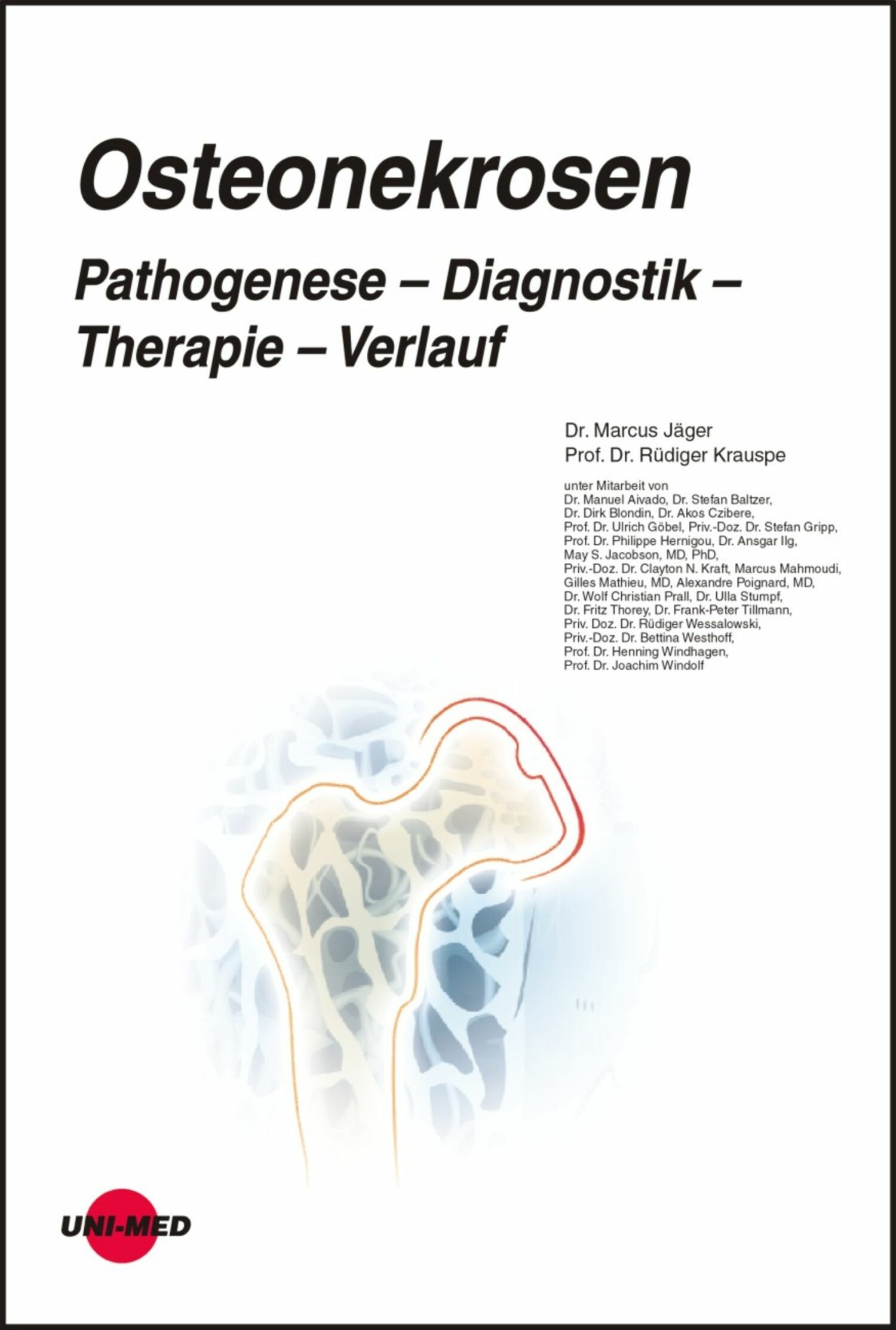 Cover Osteonekrosen. Pathogenese - Diagnostik - Therapie - Verlauf