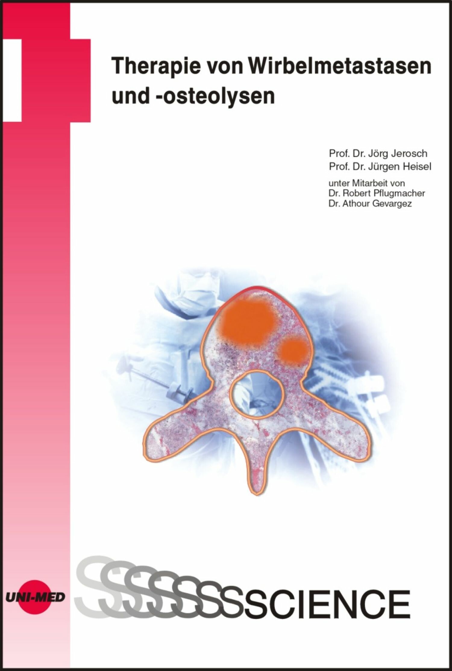Cover Therapie von Wirbelmetastasen und -osteolysen
