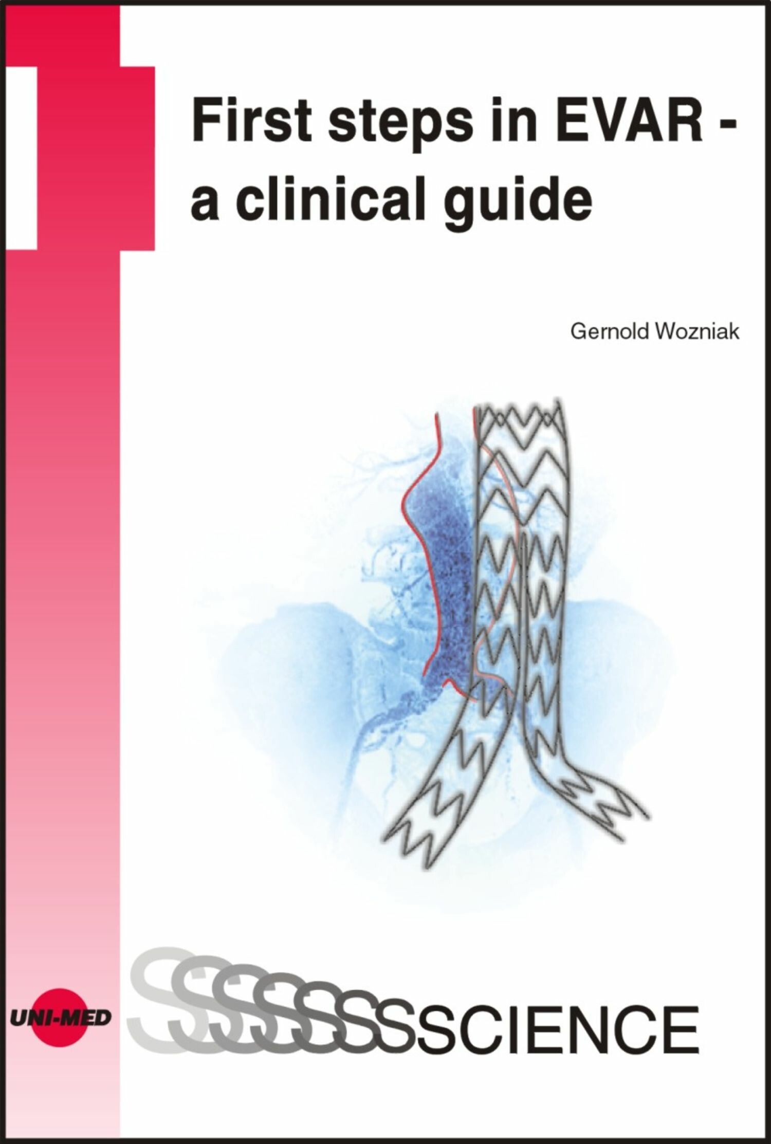 Cover First steps in EVAR - a clinical guide