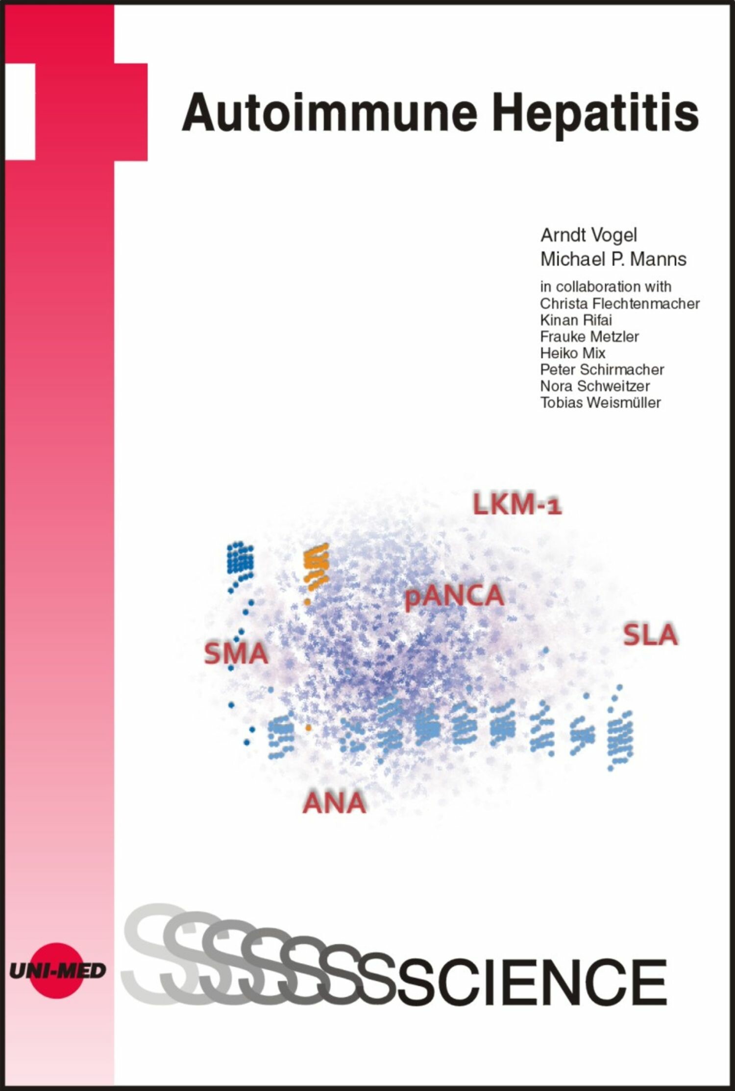 Cover Autoimmune Hepatitis