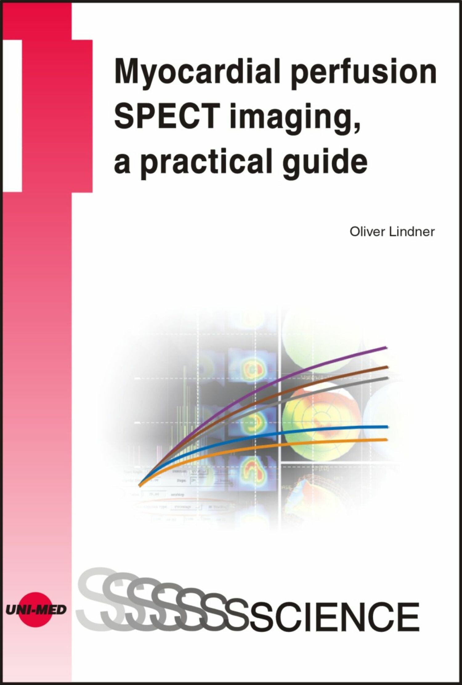 Myocardial perfusion SPECT imaging, a practical guide