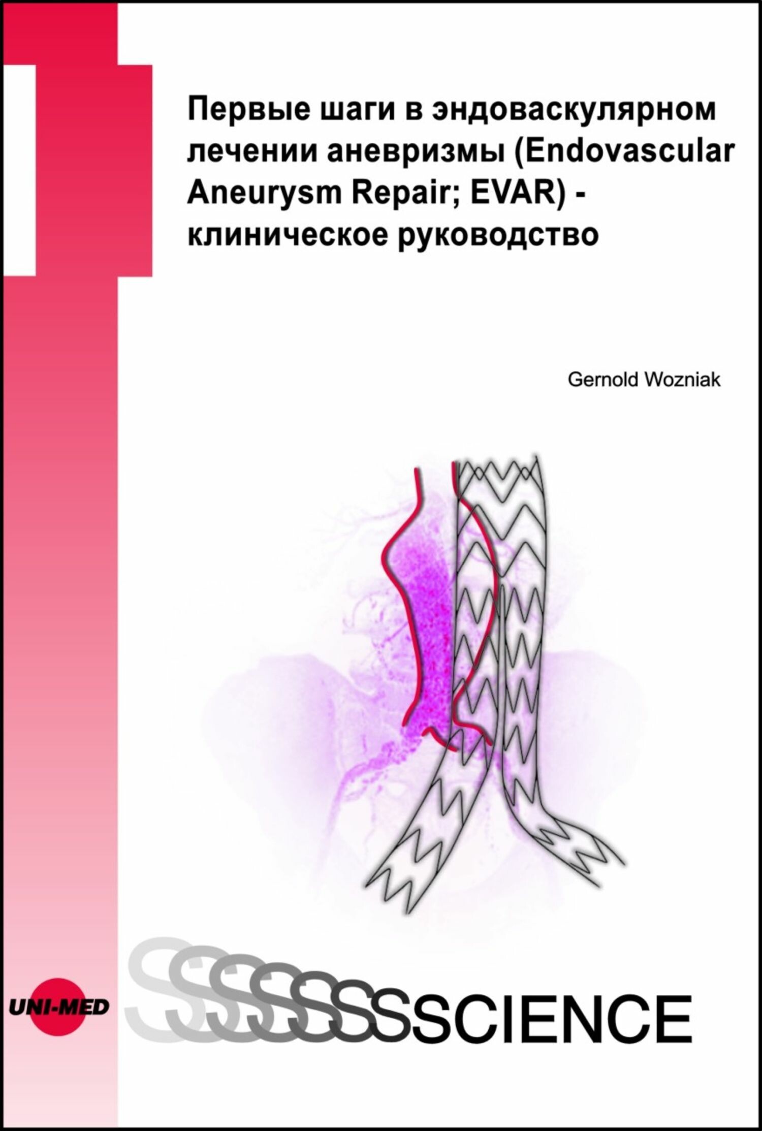 Cover First steps in EVAR - a clinical guide - Russian edition