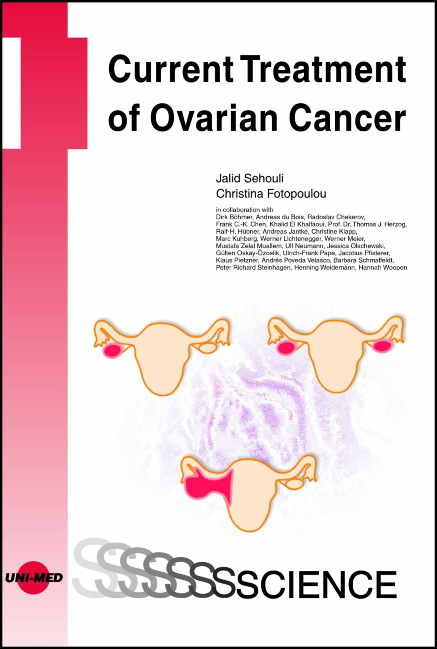 Cover Current Treatment of Ovarian Cancer