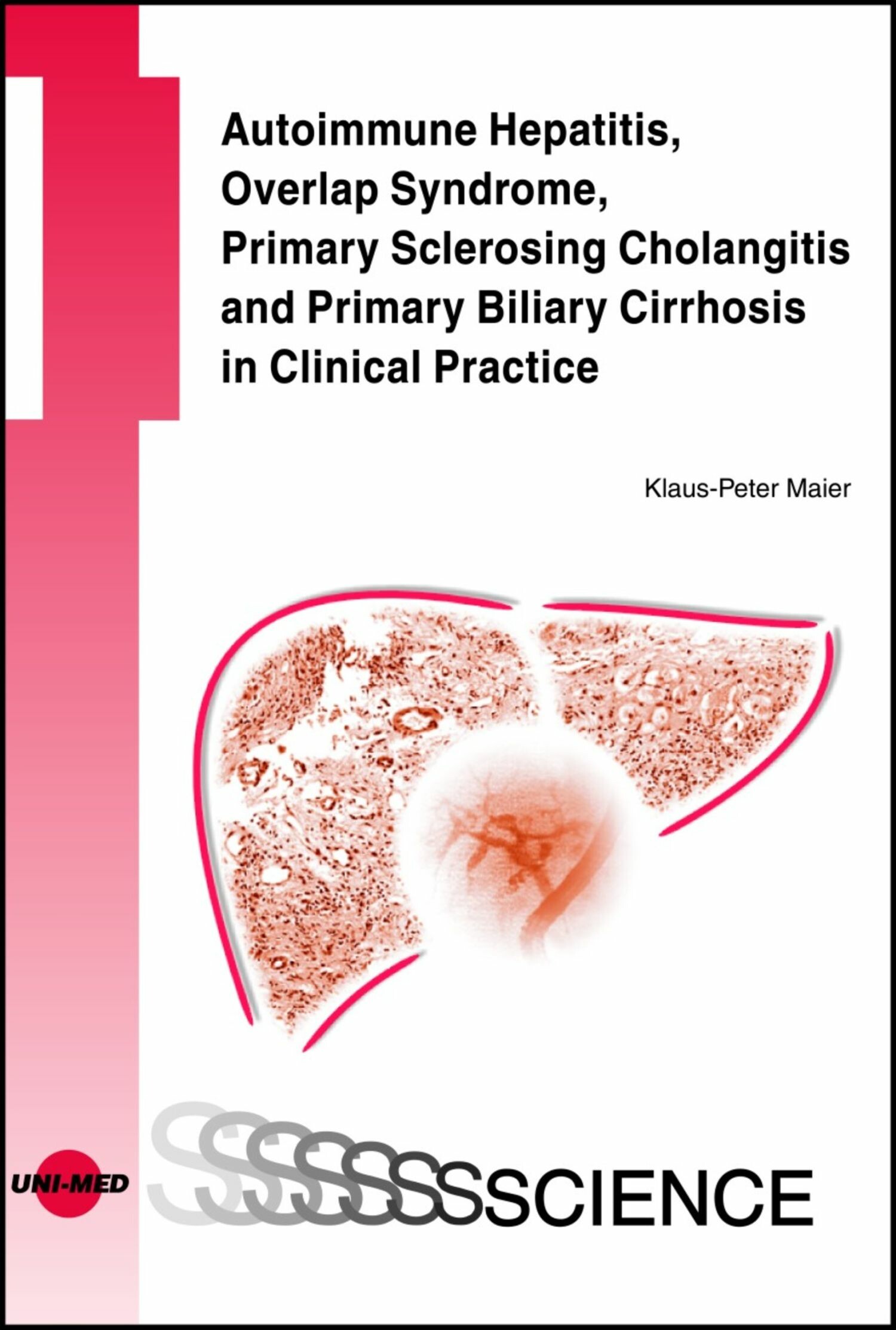 Autoimmune Hepatitis, Overlap Syndrome, Primary Sclerosing Cholangitis