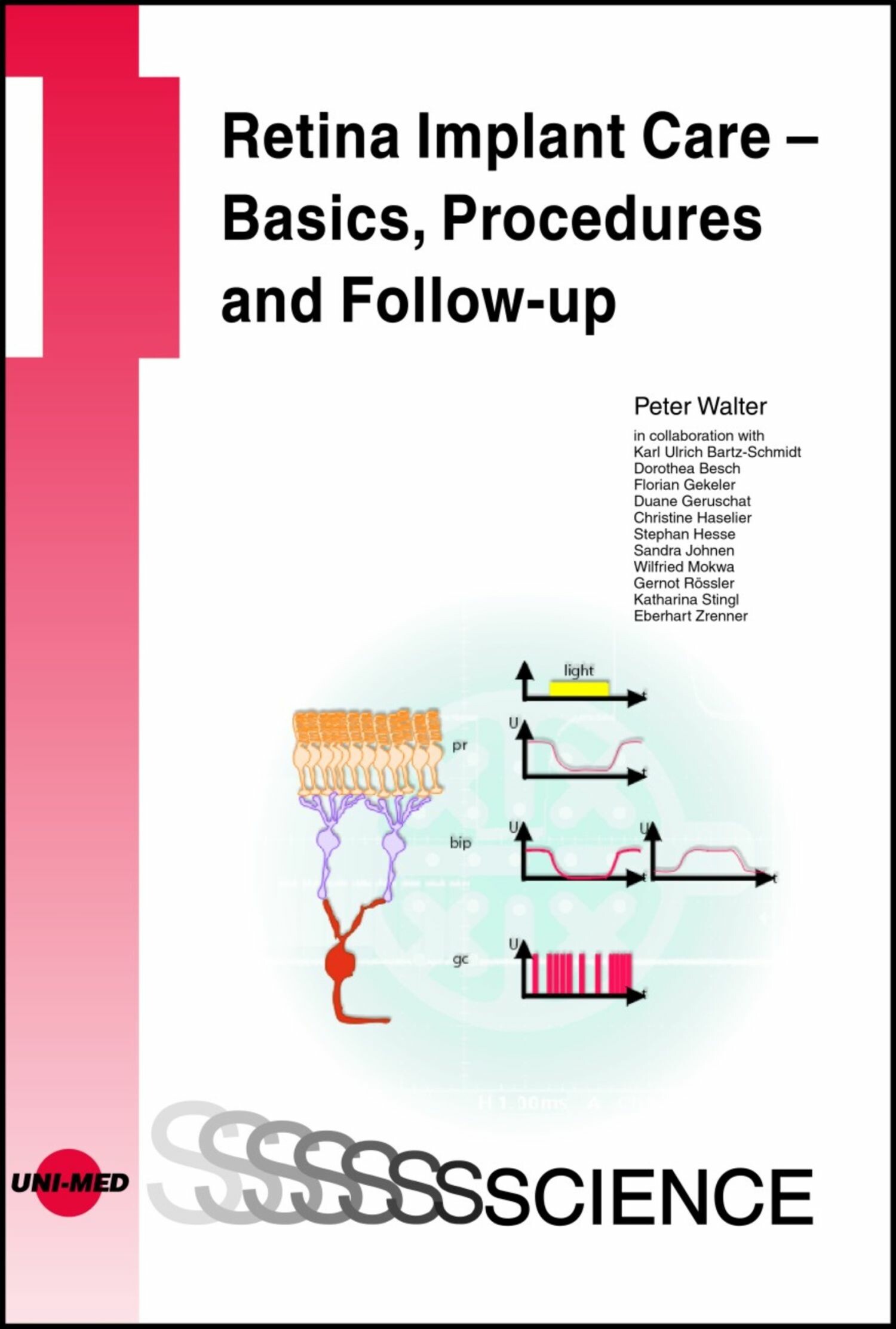 Retina Implant Care - Basics, Procedures and Follow-up