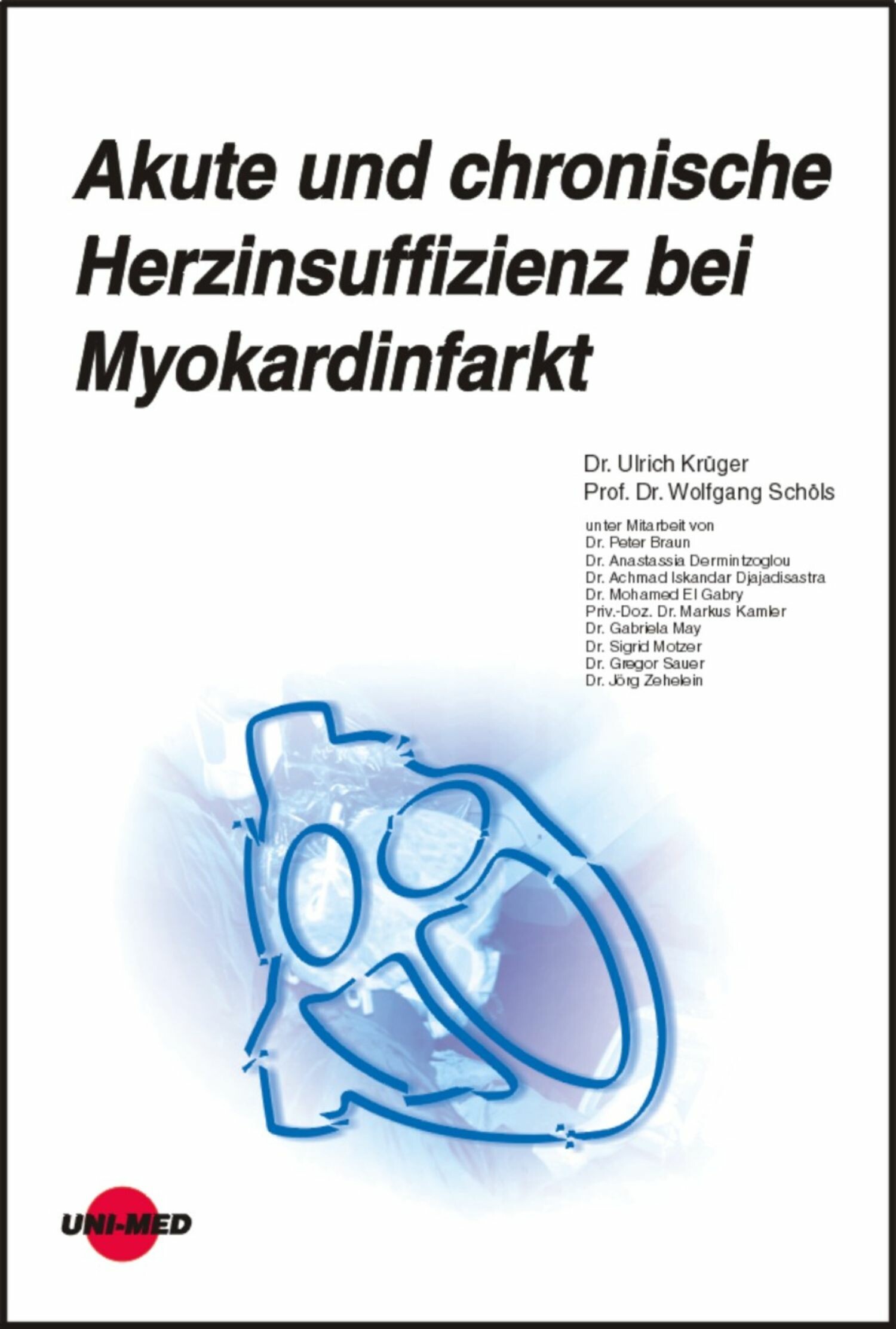 Akute und chronische Herzinsuffizienz bei Myokardinfarkt