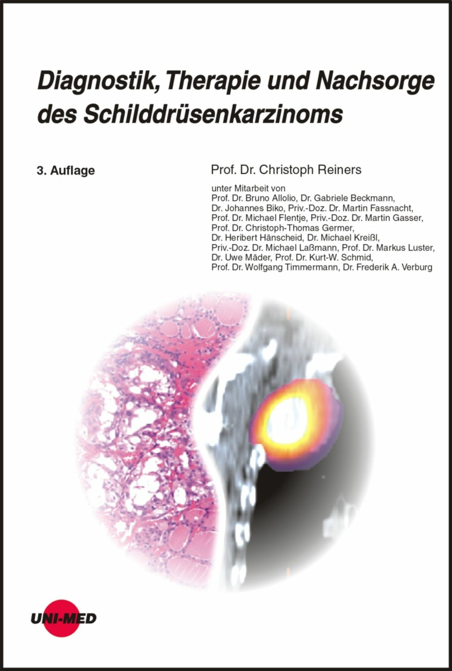 Cover Diagnostik, Therapie und Nachsorge des Schilddrüsenkarzinoms