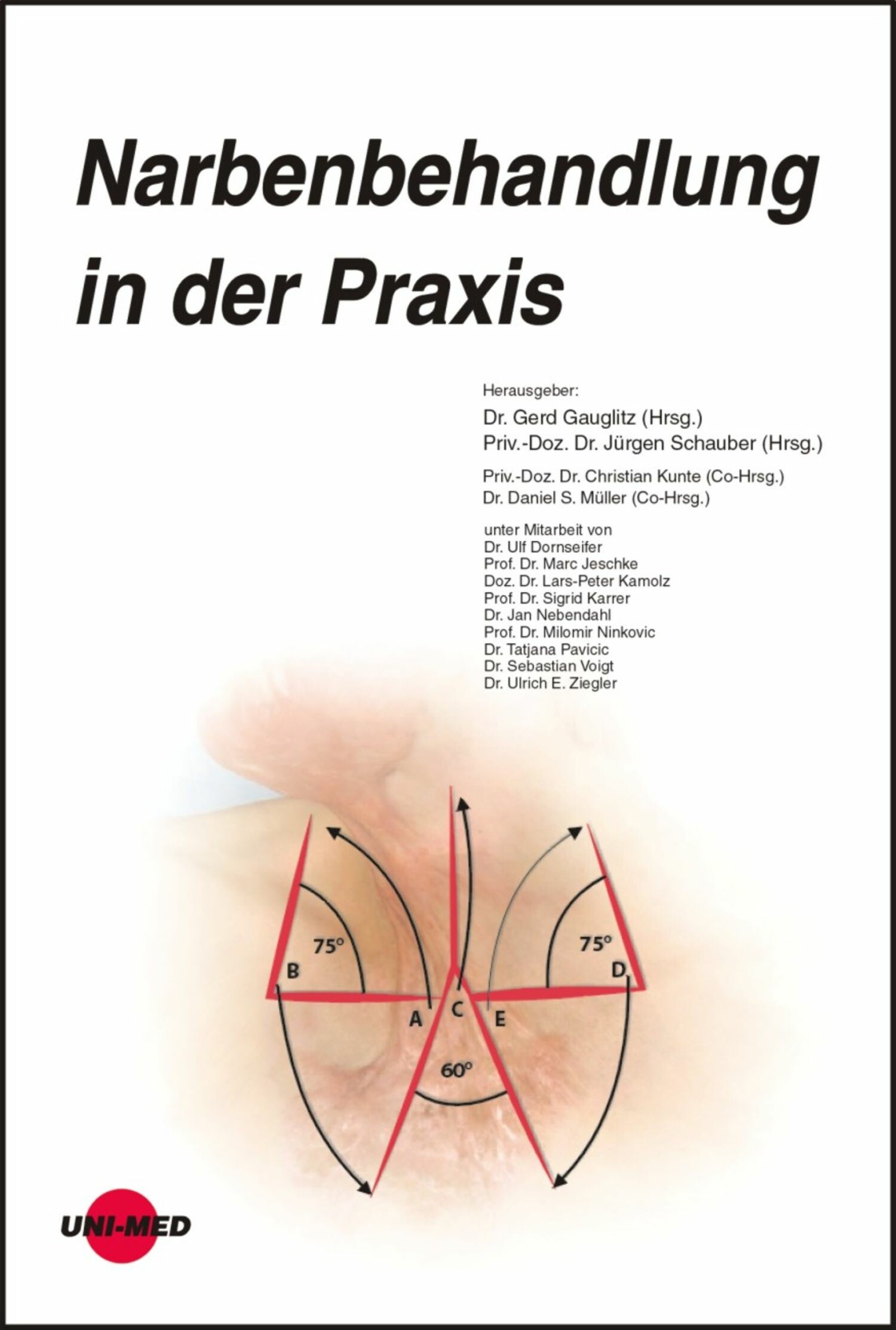 Narbenbehandlung in der Praxis