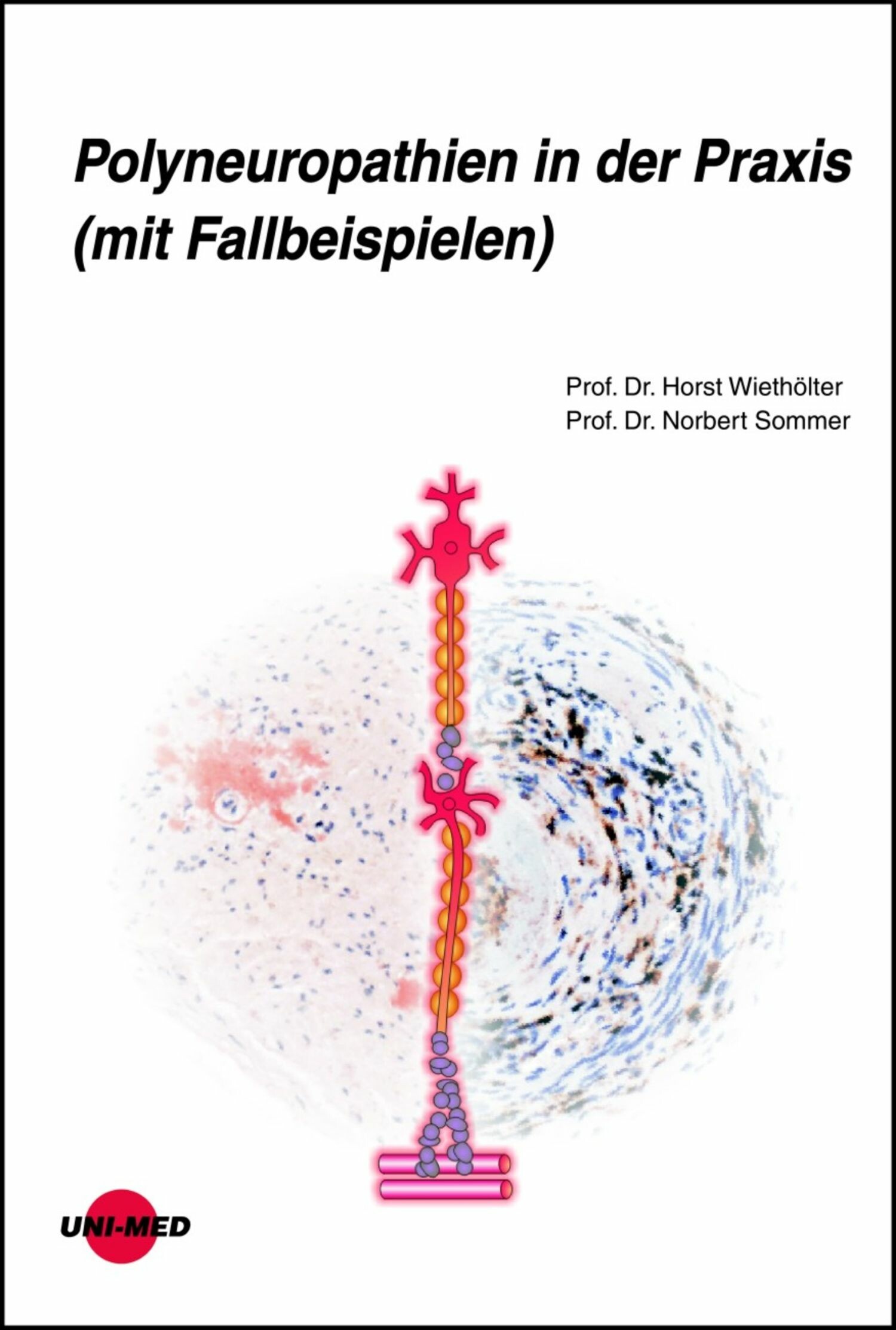 Cover Polyneuropathien in der Praxis (mit Fallbeispielen)