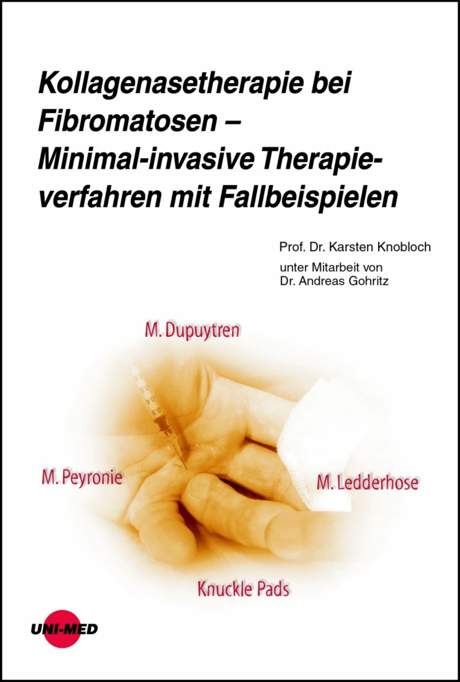 Cover Kollagenasetherapie bei Fibromatosen - Minimal-invasive Therapieverfahren mit Fallbeispielen