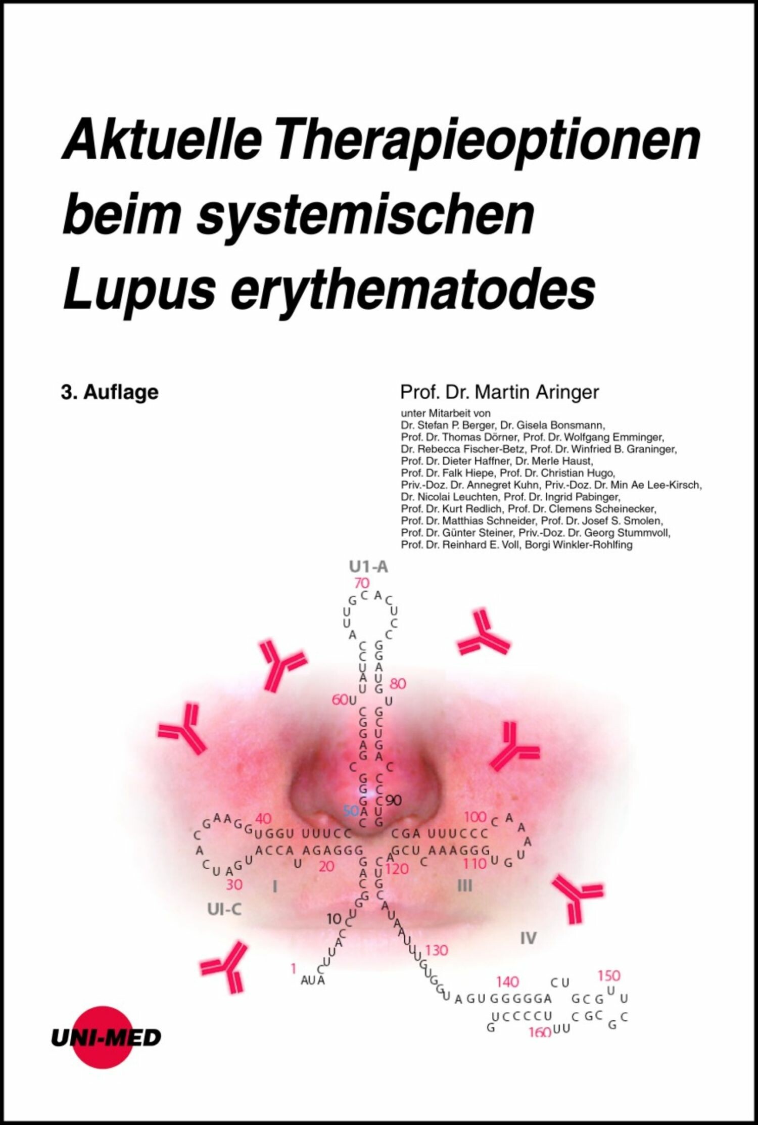 Aktuelle Therapieoptionen beim systemischen Lupus erythematodes