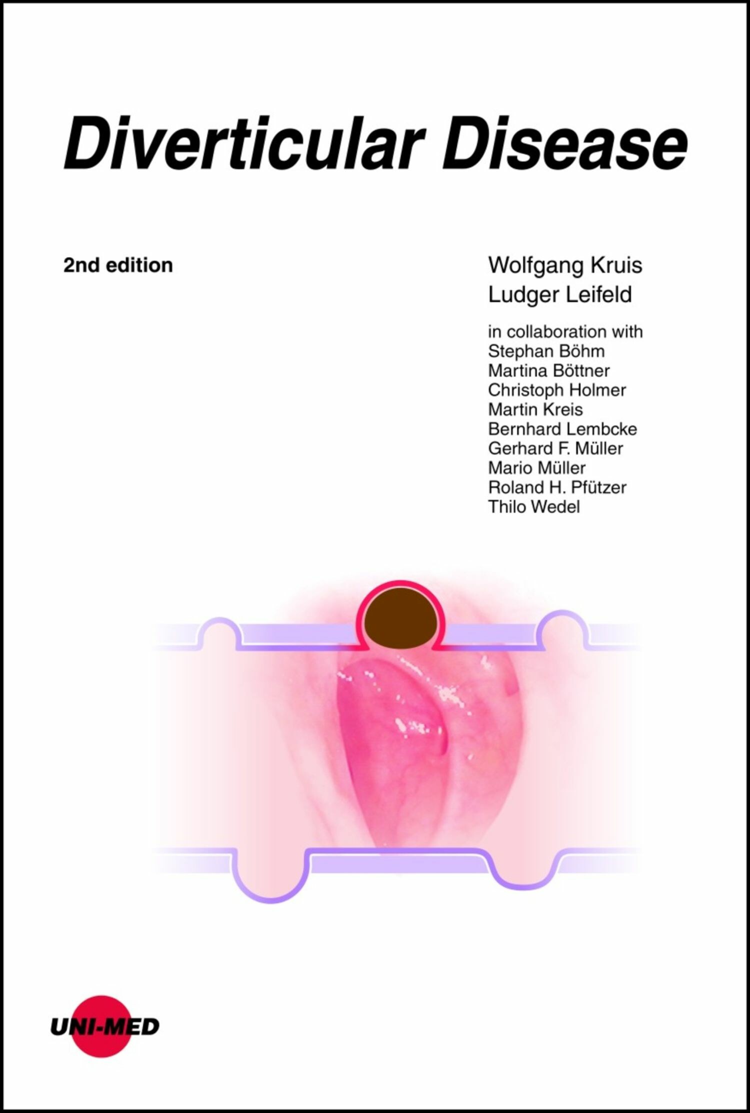 Diverticular Disease