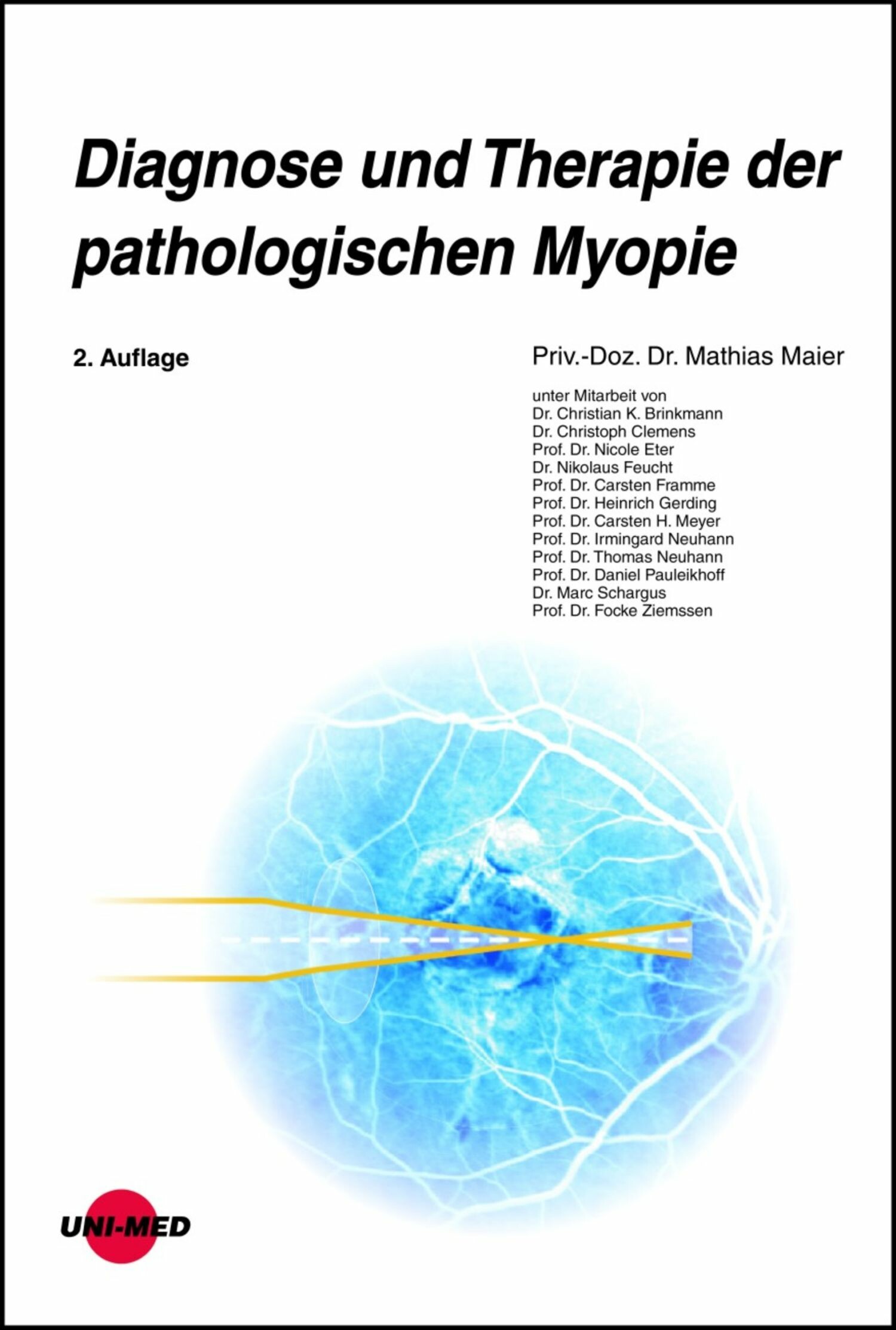 Cover Diagnose und Therapie der pathologischen Myopie