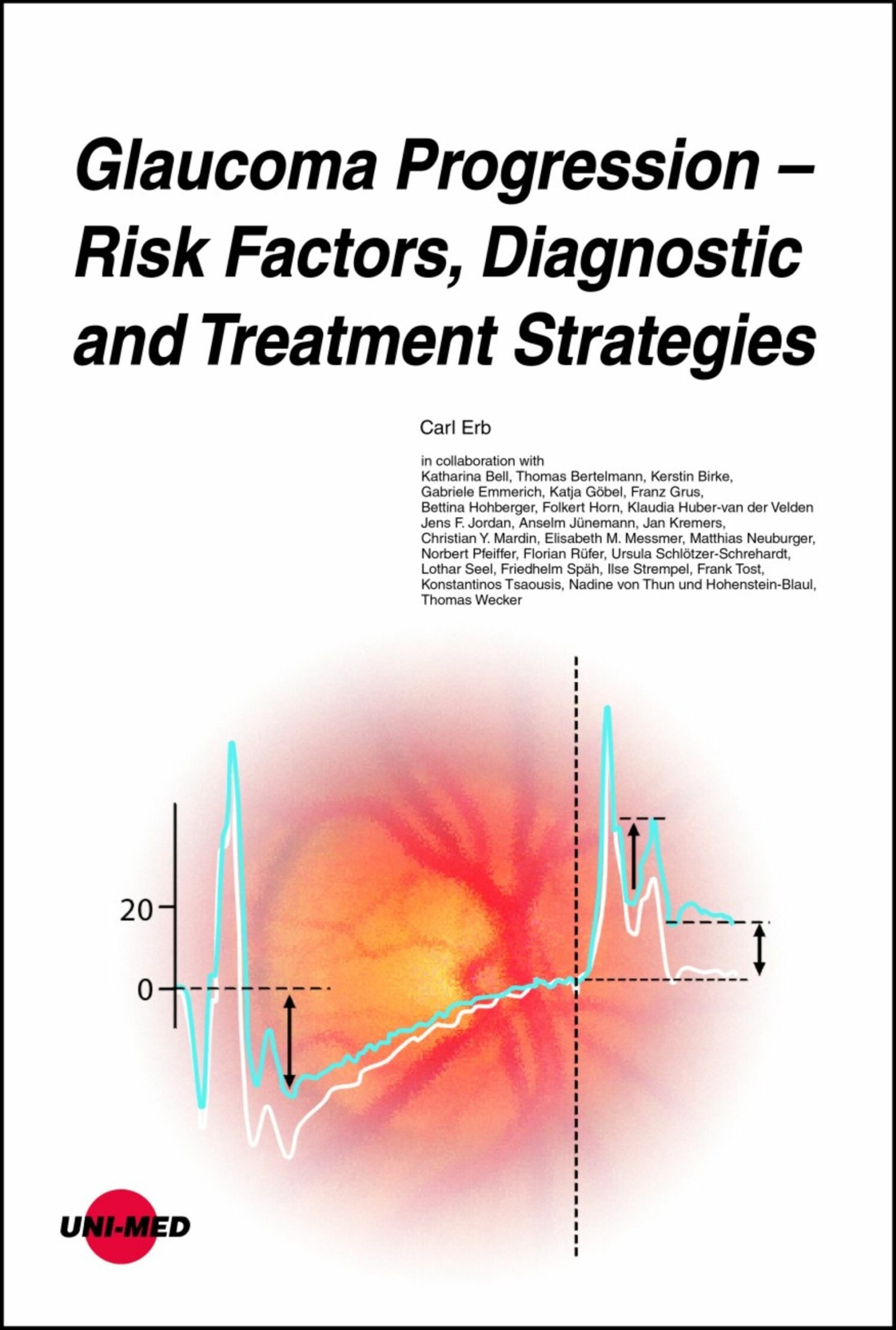 Cover Glaucoma Progression - Risk Factors, Diagnostic and Treatment Strategies