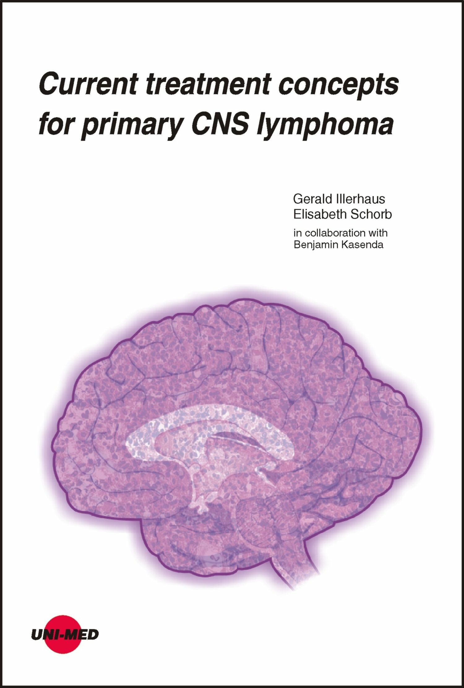 Cover Current treatment concepts for primary CNS lymphoma