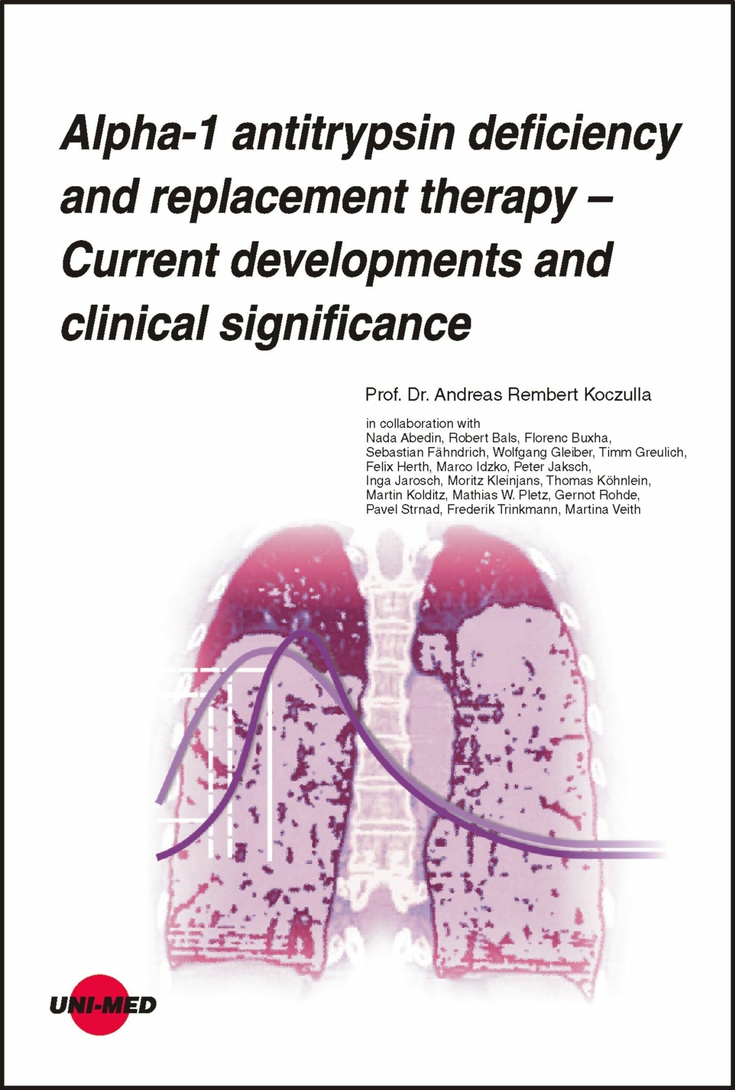 Cover Alpha-1 antitrypsin deficiency and replacement therapy - Current developments and clinical significance