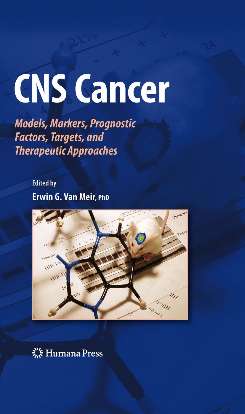 CNS Cancer