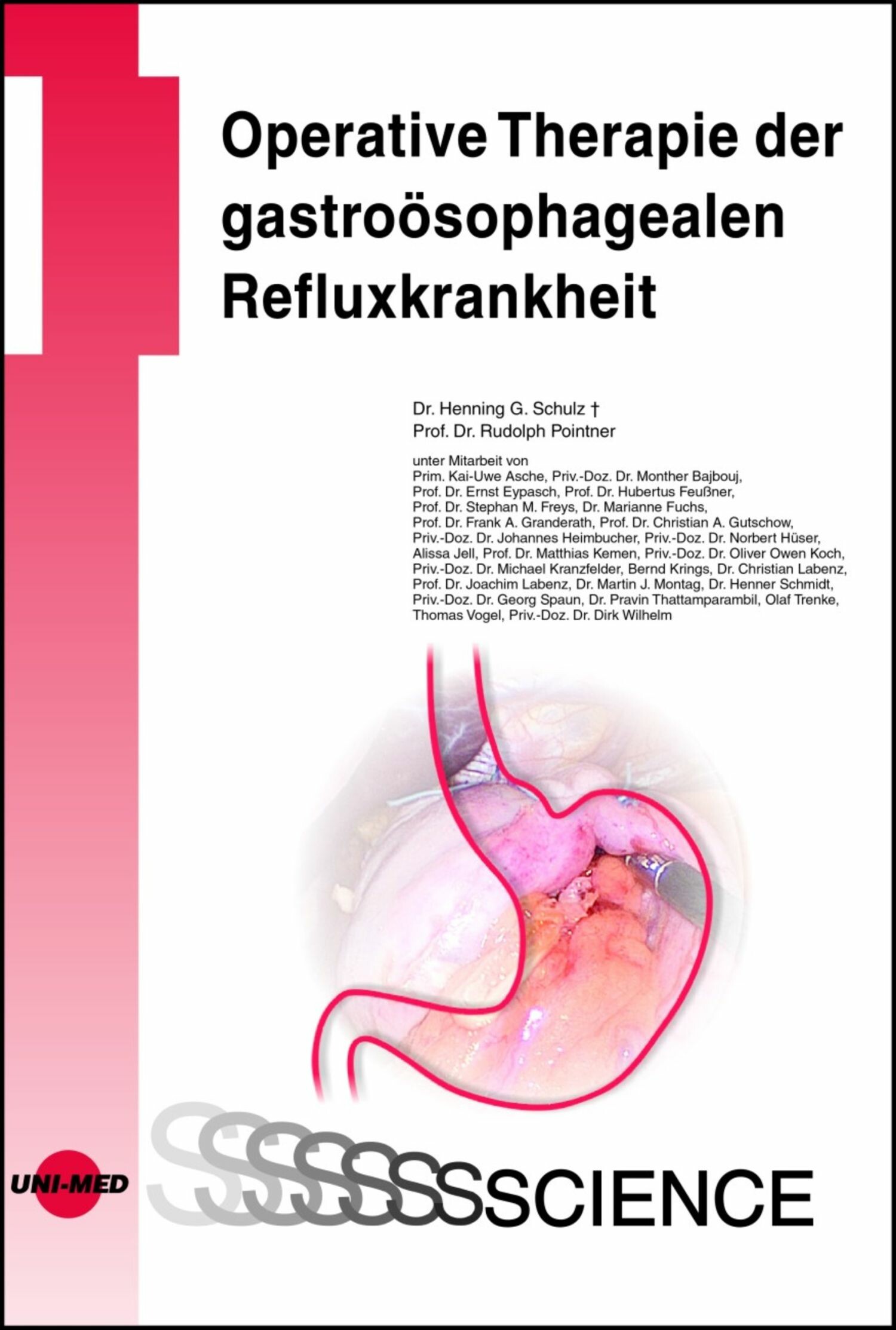 Cover Operative Therapie der gastroösophagealen Refluxkrankheit