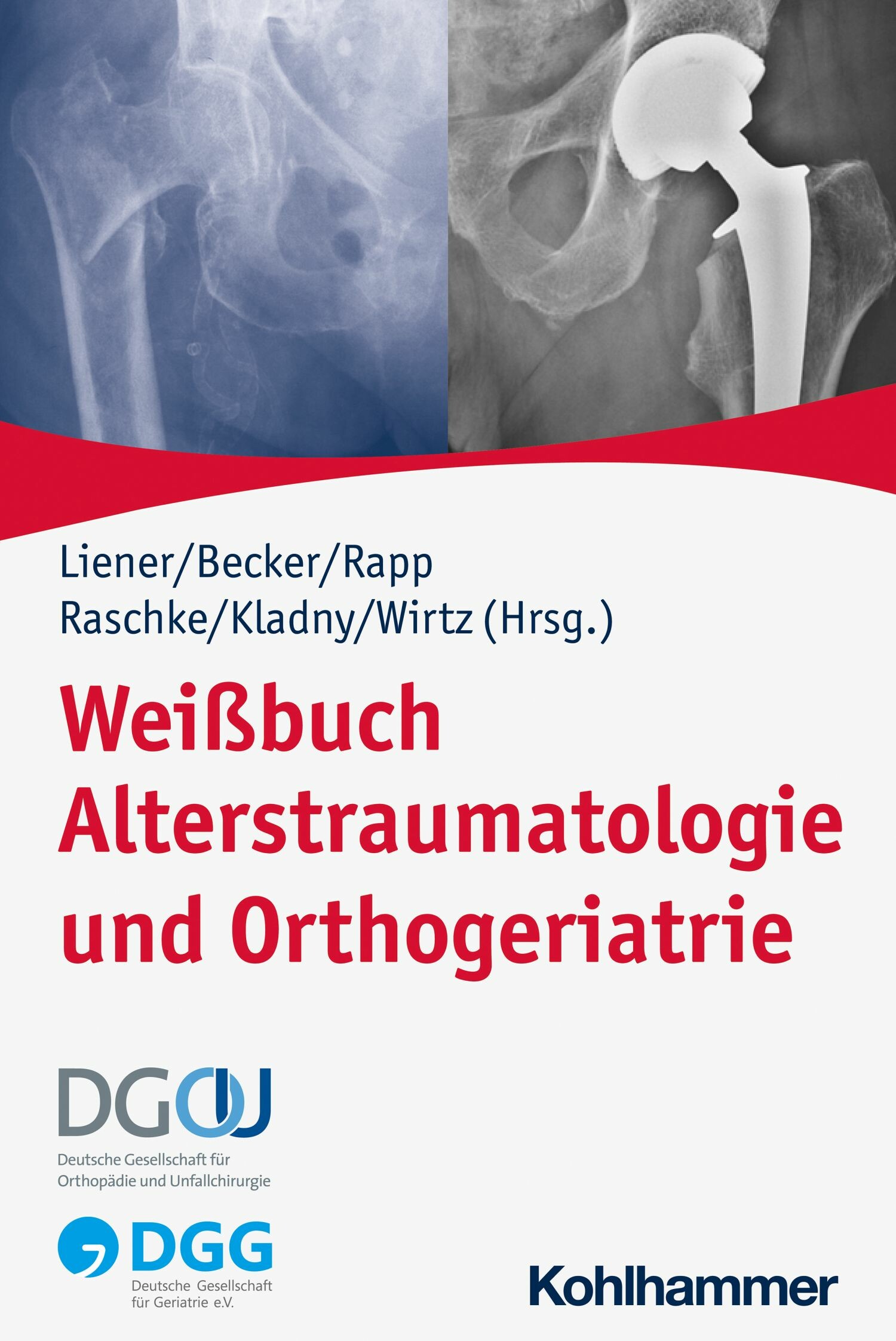 Cover Weißbuch Alterstraumatologie und Orthogeriatrie