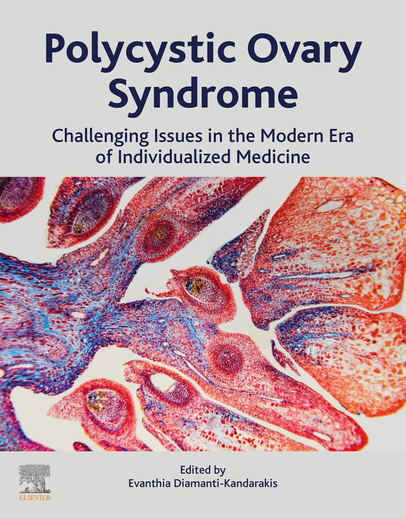 Cover Polycystic Ovary Syndrome