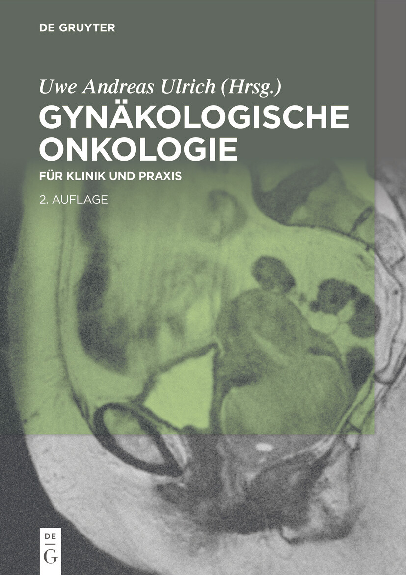 Gynäkologische Onkologie