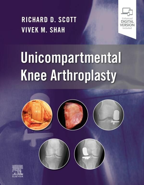 Cover Unicompartmental Knee Arthroplasty, E-Book