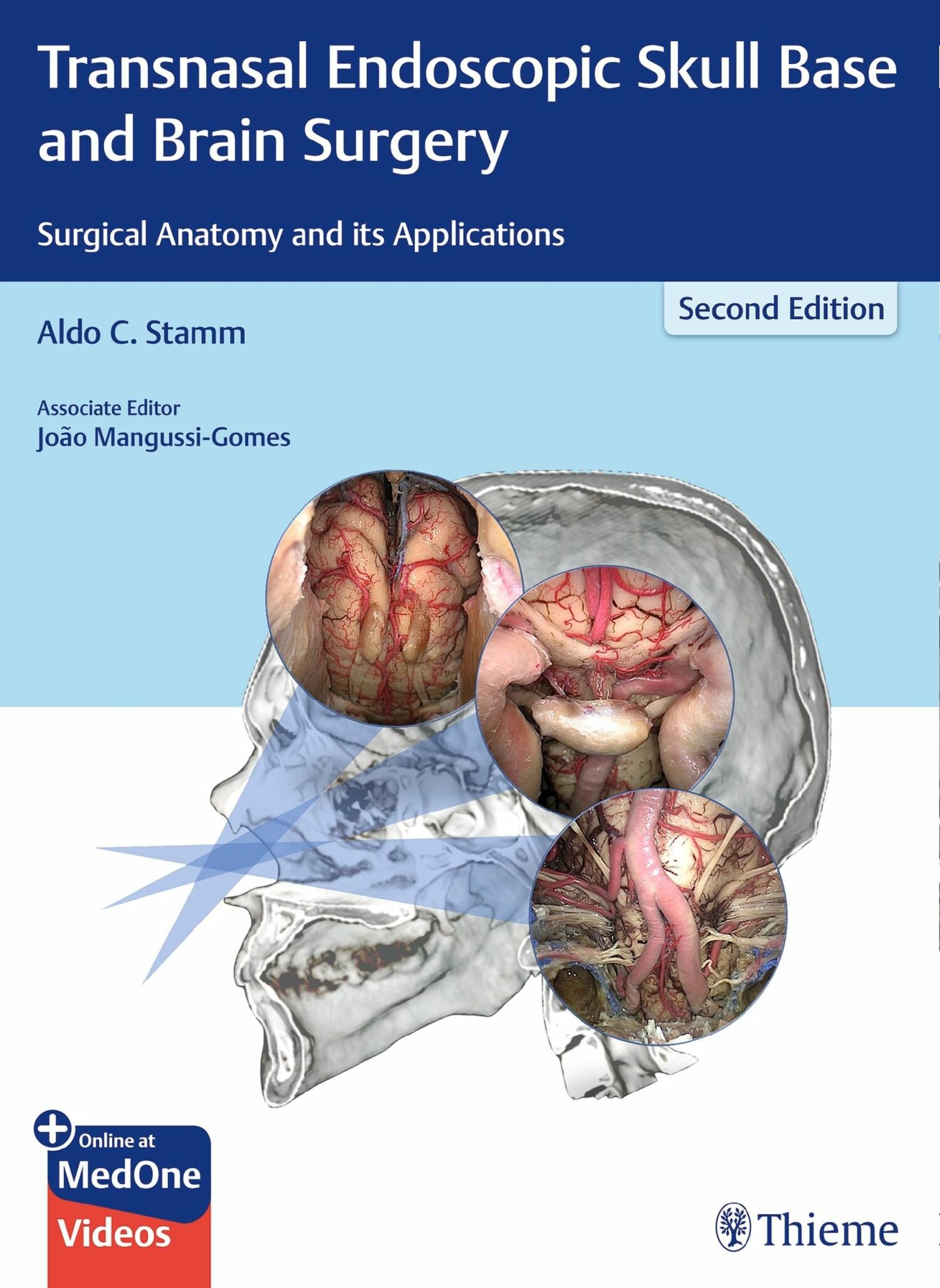 Cover Transnasal Endoscopic Skull Base and Brain Surgery