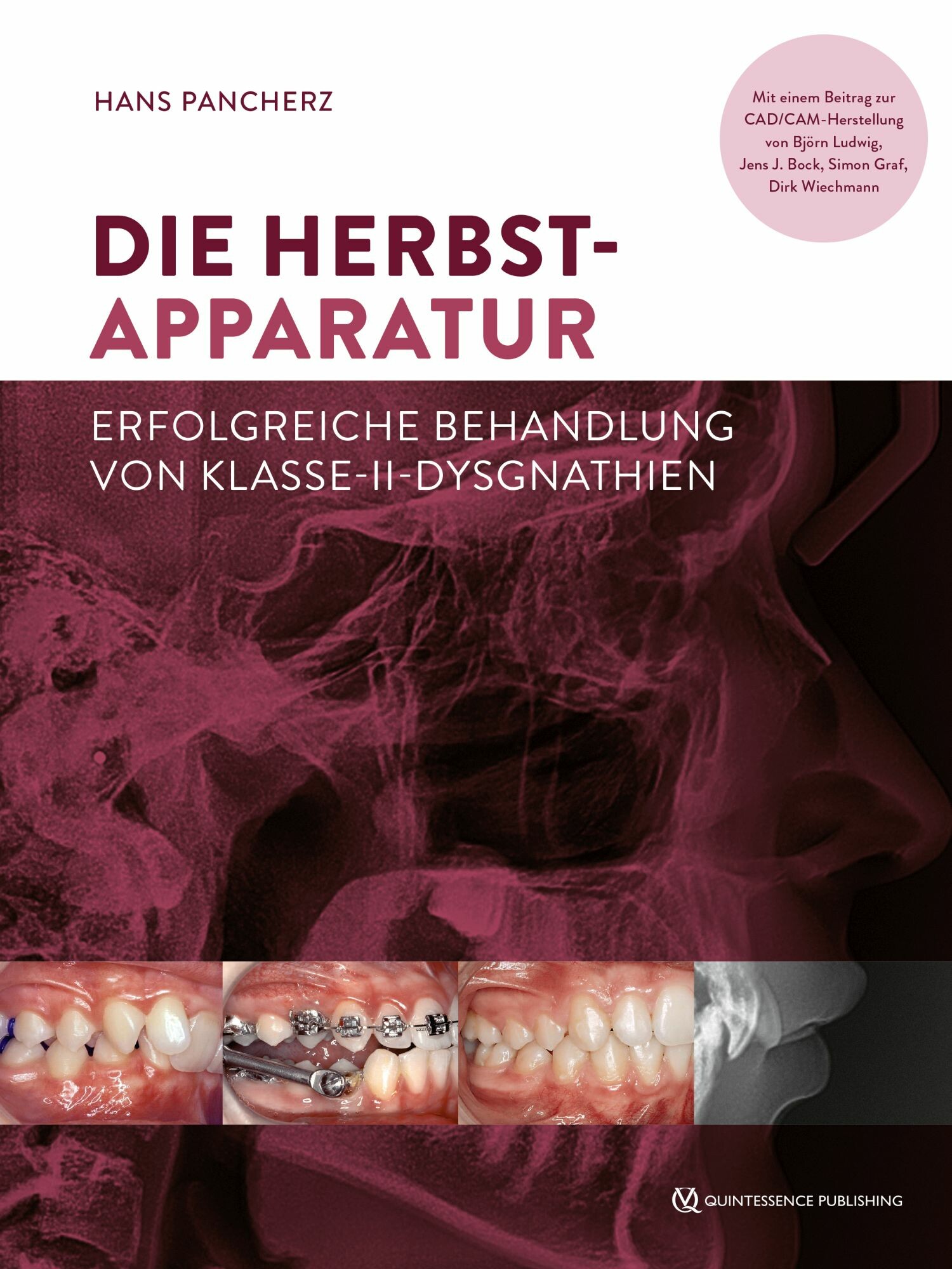 Cover Die Herbst-Apparatur