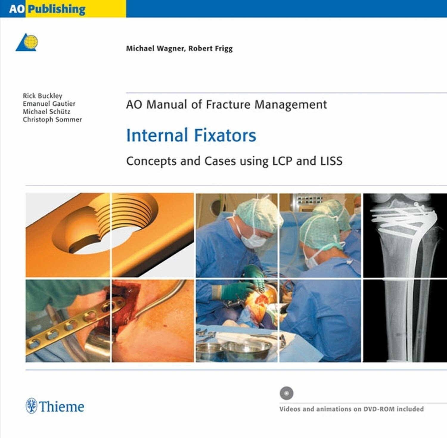 Cover AO Manual of Fracture Management: Internal Fixators