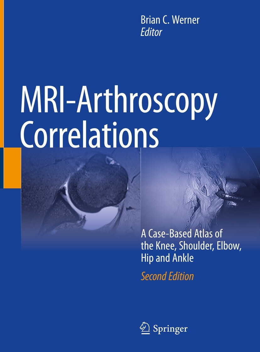 Cover MRI-Arthroscopy Correlations