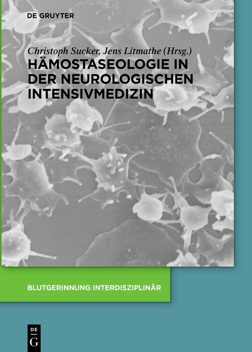 Cover Hämostaseologie in der neurologischen Intensivmedizin