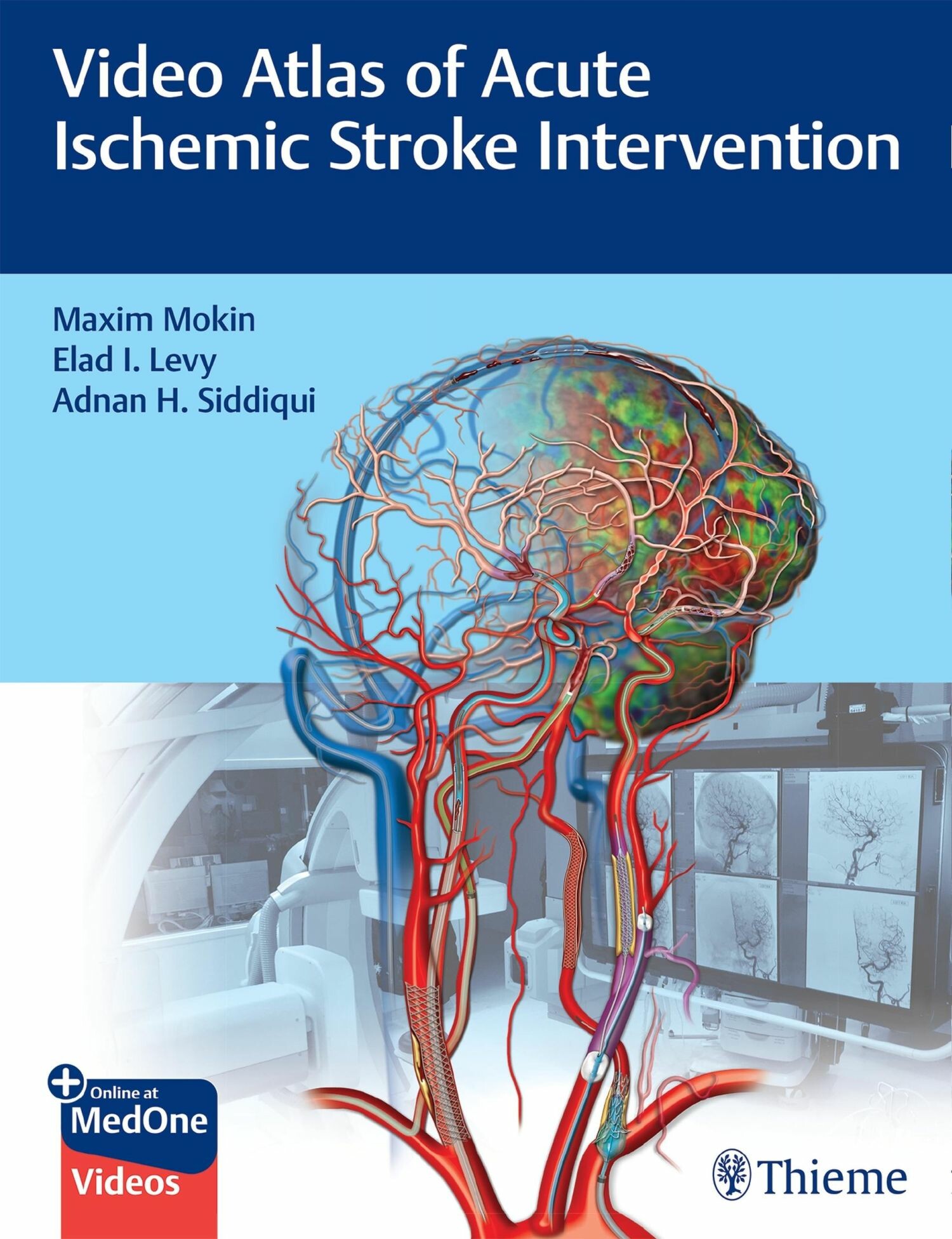 Cover Video Atlas of Acute Ischemic Stroke Intervention
