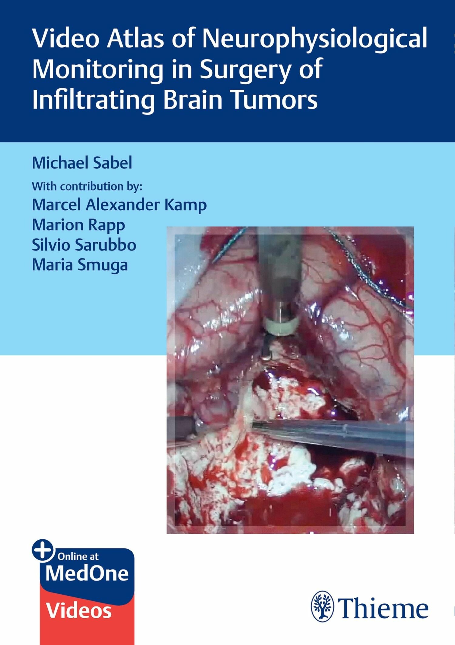 Cover Video Atlas of Neurophysiological Monitoring in Surgery of Infiltrating Brain Tumors
