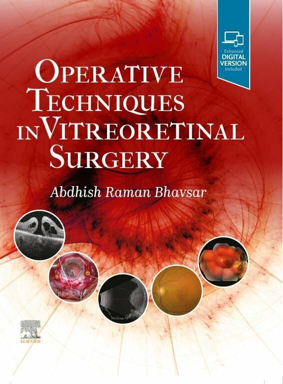 Cover Operative Techniques in Vitreoretinal Surgery E-Book