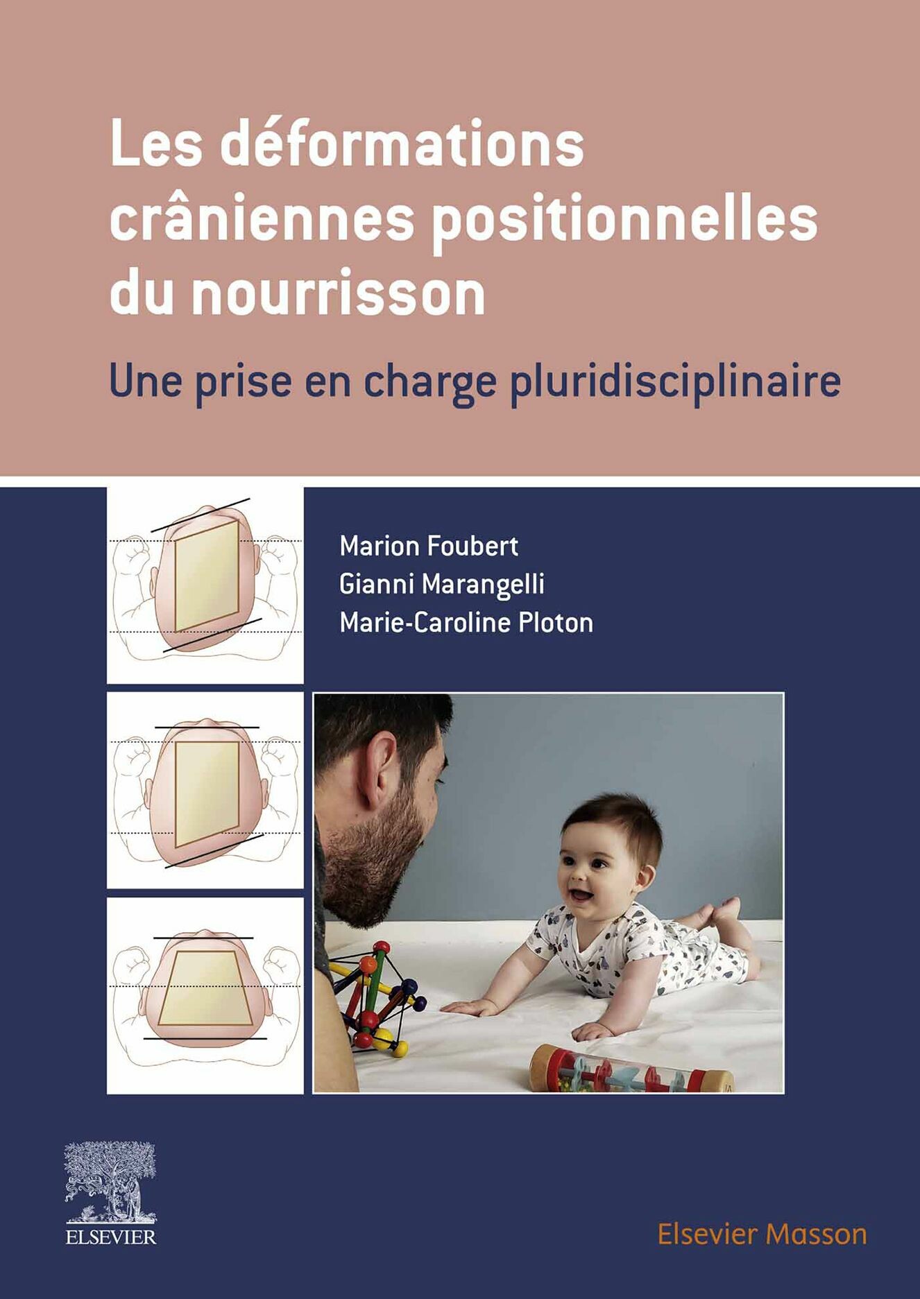 Cover Les déformations crâniennes positionnelles du nourrisson