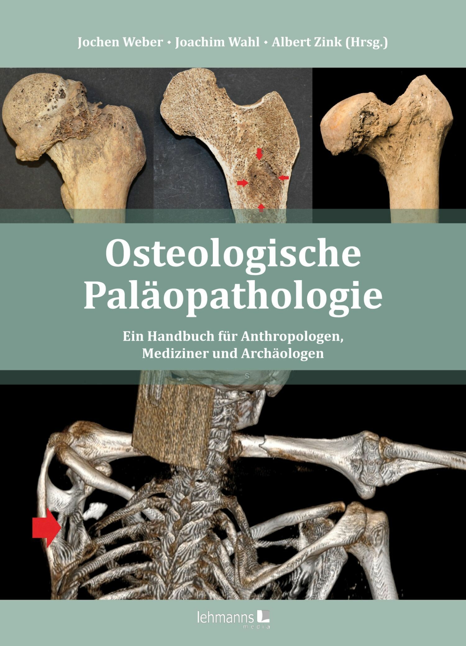 Cover Osteologische Paläopathologie