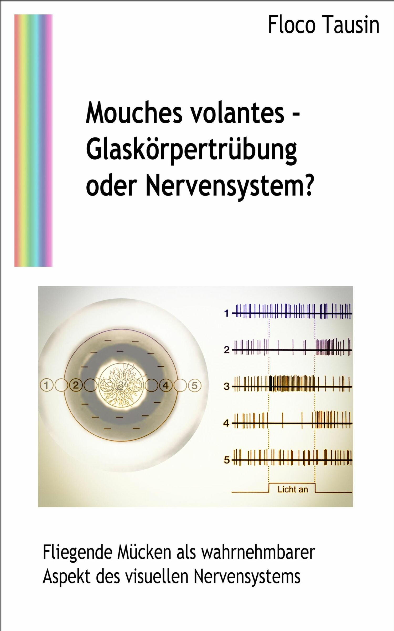 Cover Mouches volantes - Glaskörpertrübung oder Nervensystem?