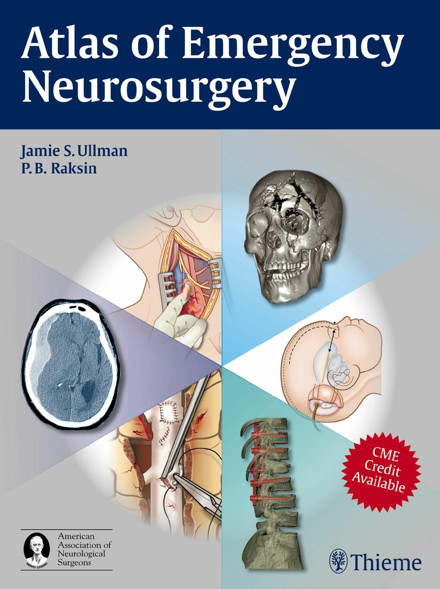 Cover Atlas of Emergency Neurosurgery
