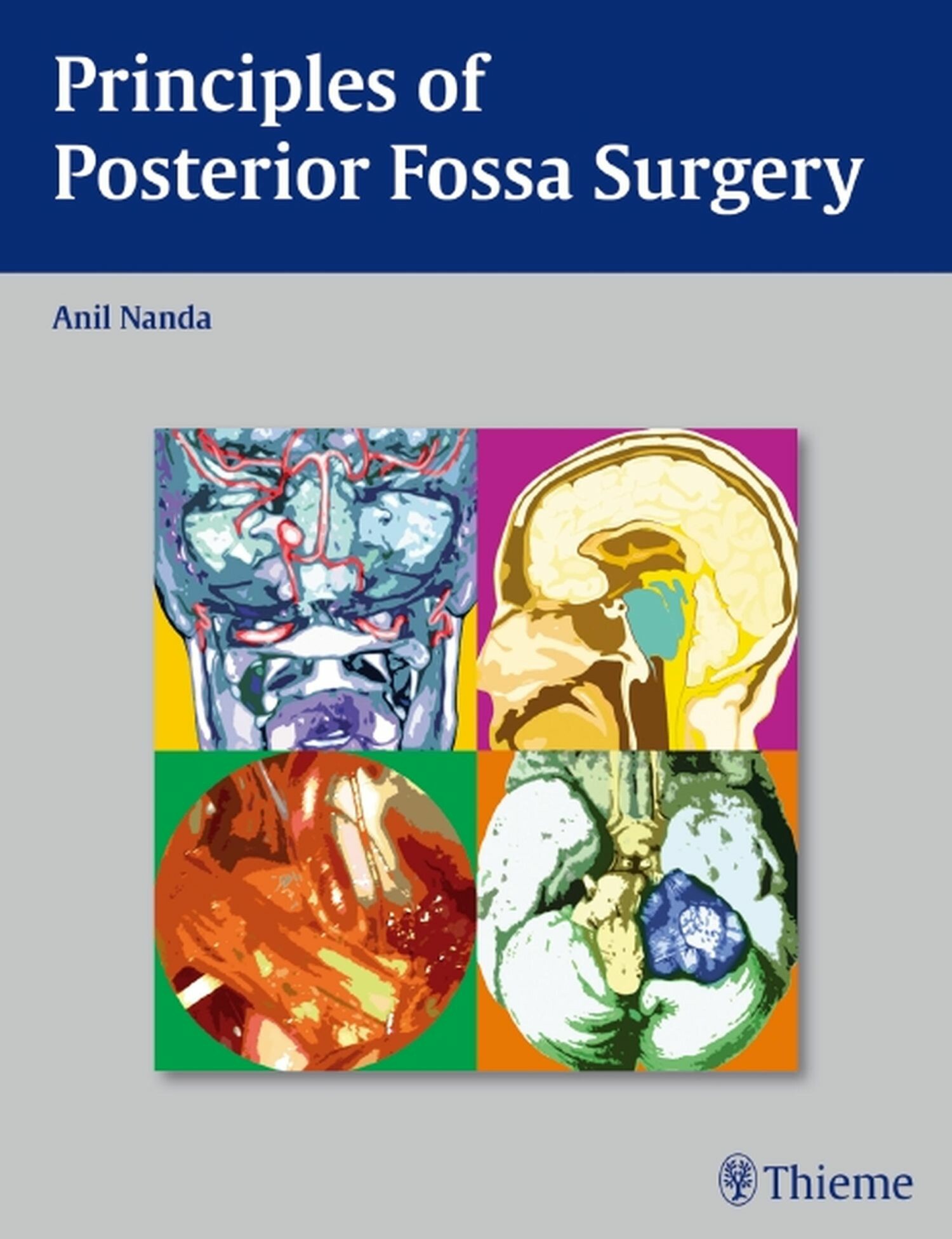Cover Principles of Posterior Fossa Surgery