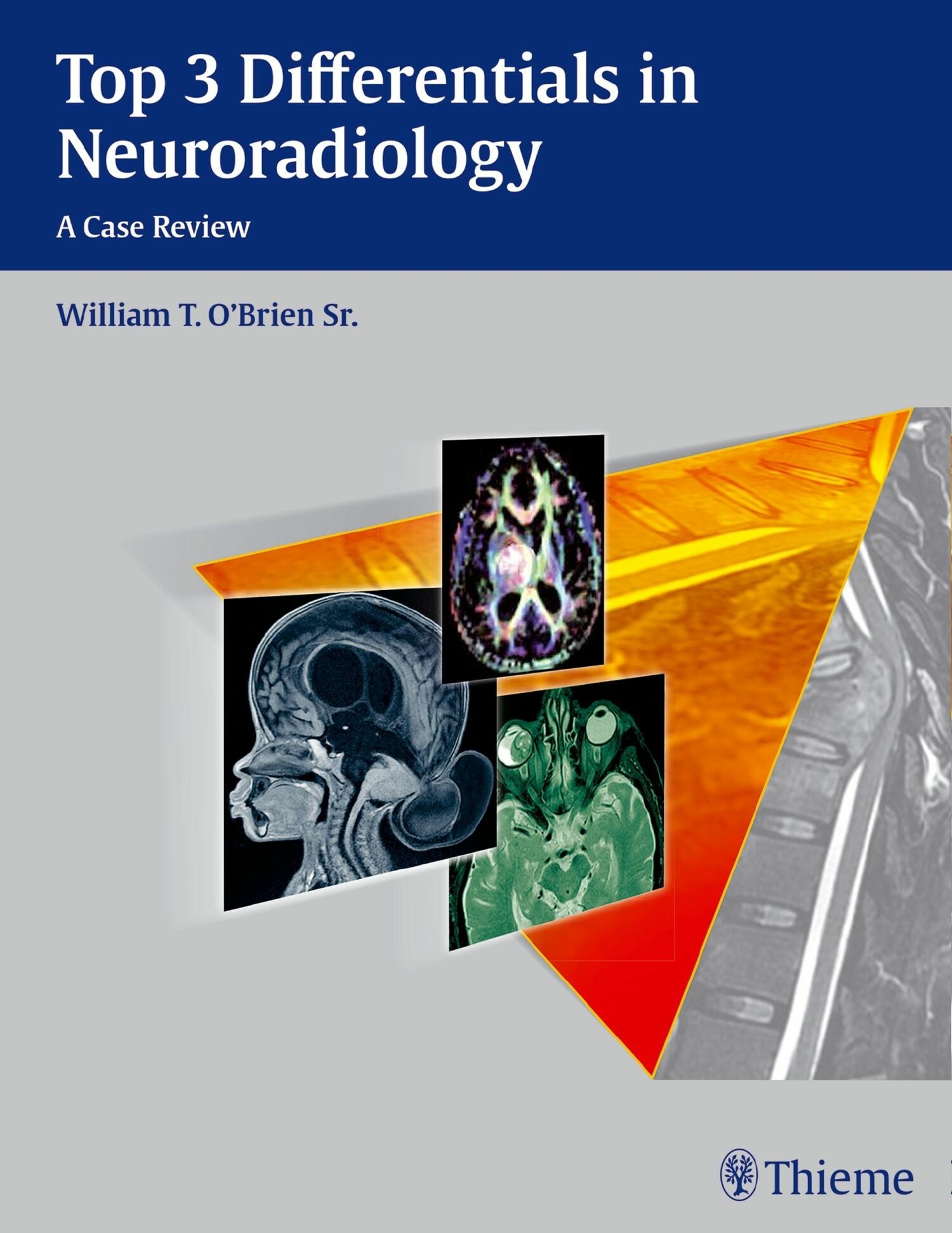 Cover Top 3 Differentials in Neuroradiology