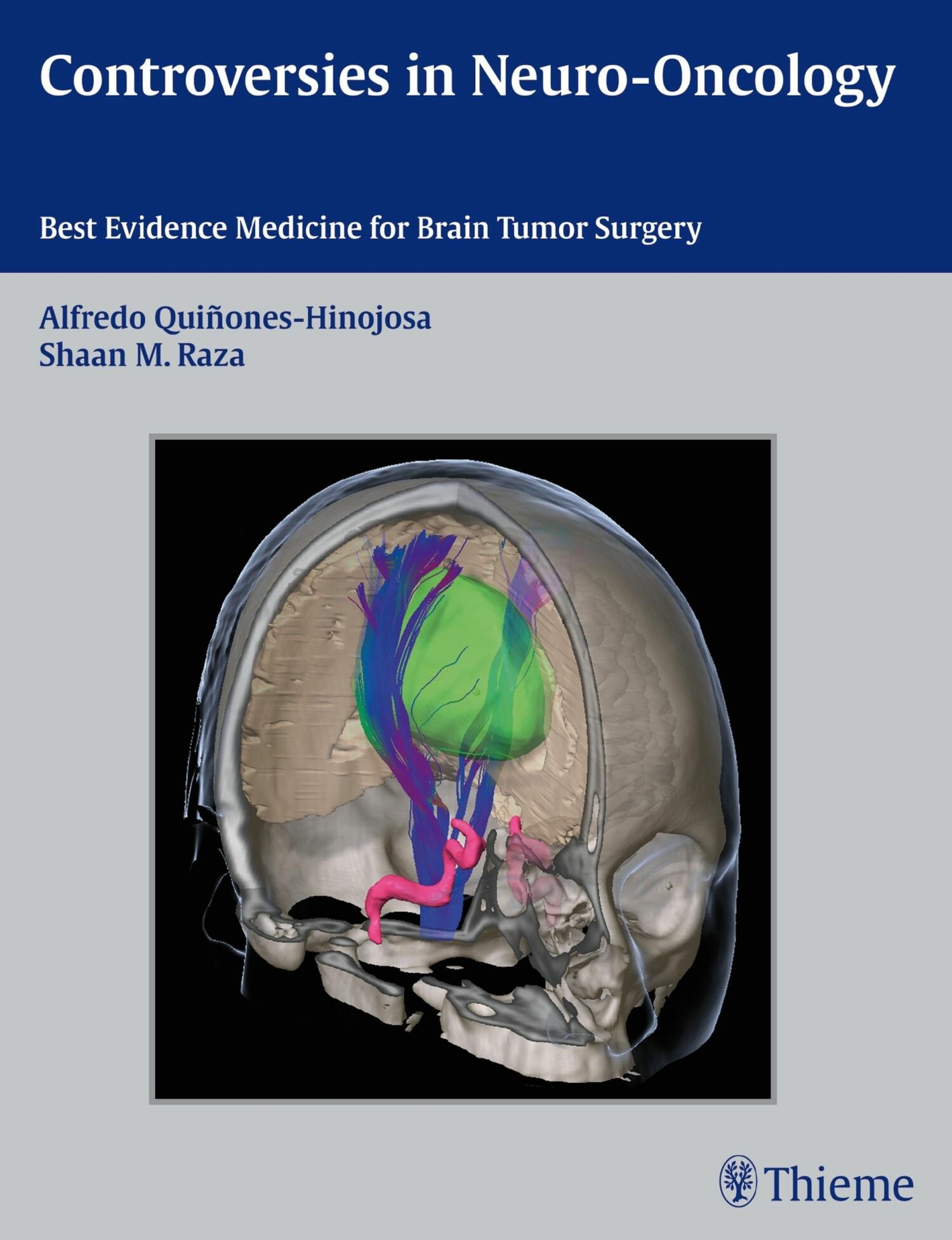 Cover Controversies in Neuro-Oncology