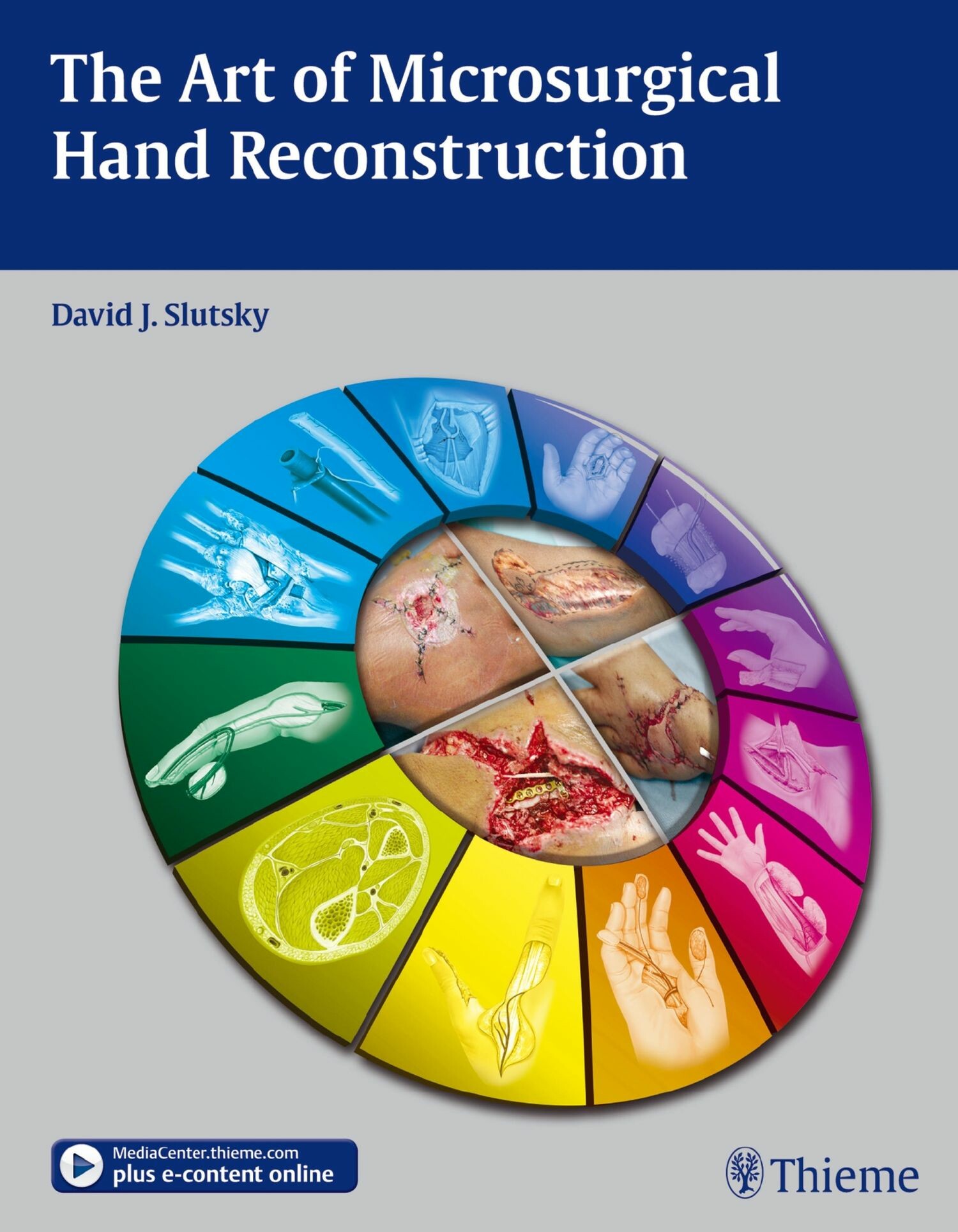 Cover The Art of Microsurgical Hand Reconstruction